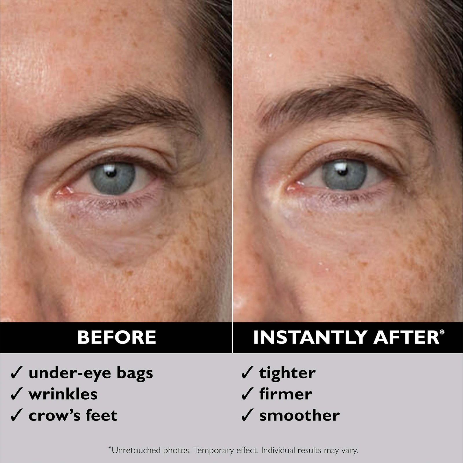 Thumbnail - Peter Thomas Roth Instant FIRMx Eye Temporary Eye Tightener 30ml