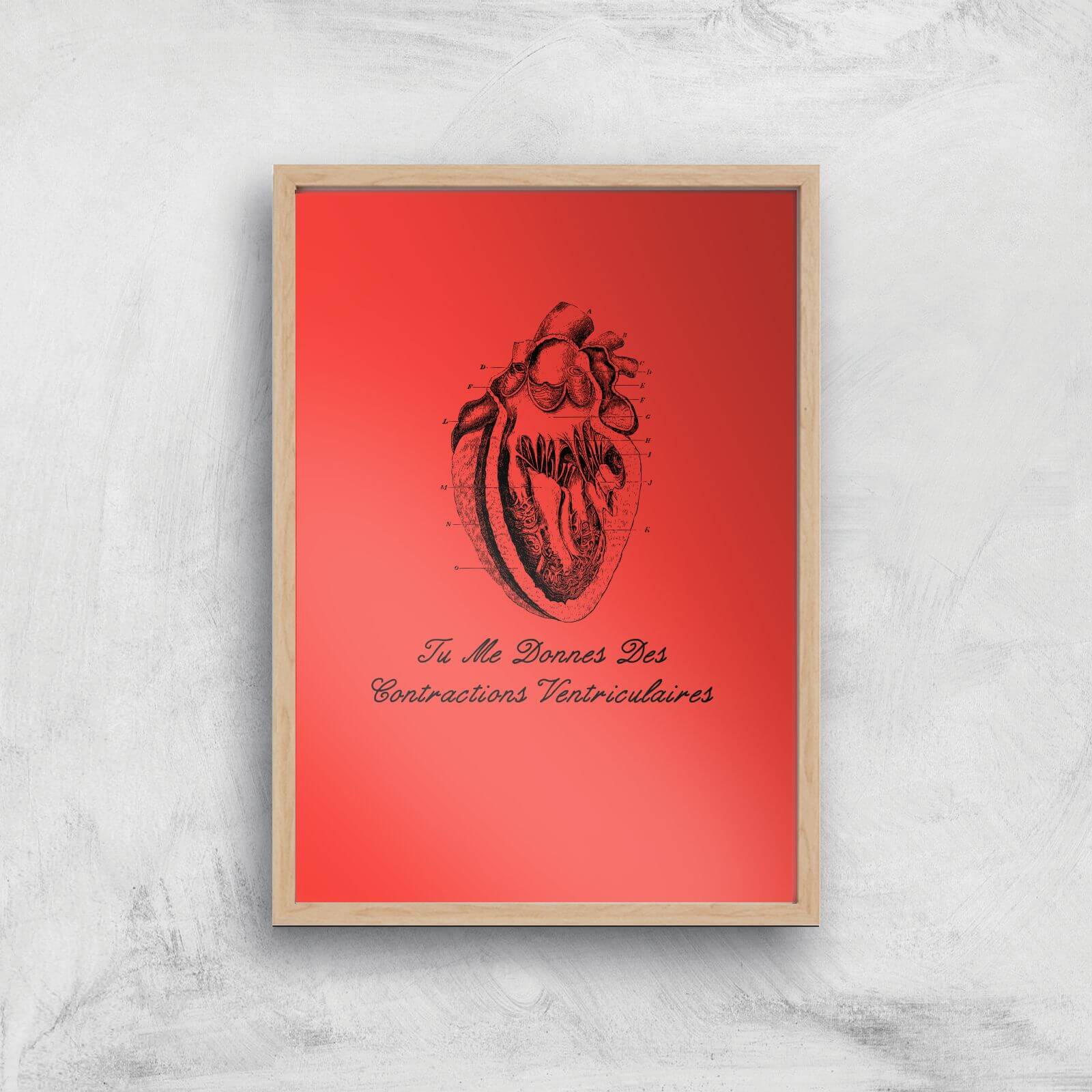 Premature Ventricular Contractions (FR) Art Print - A2 - White Frame