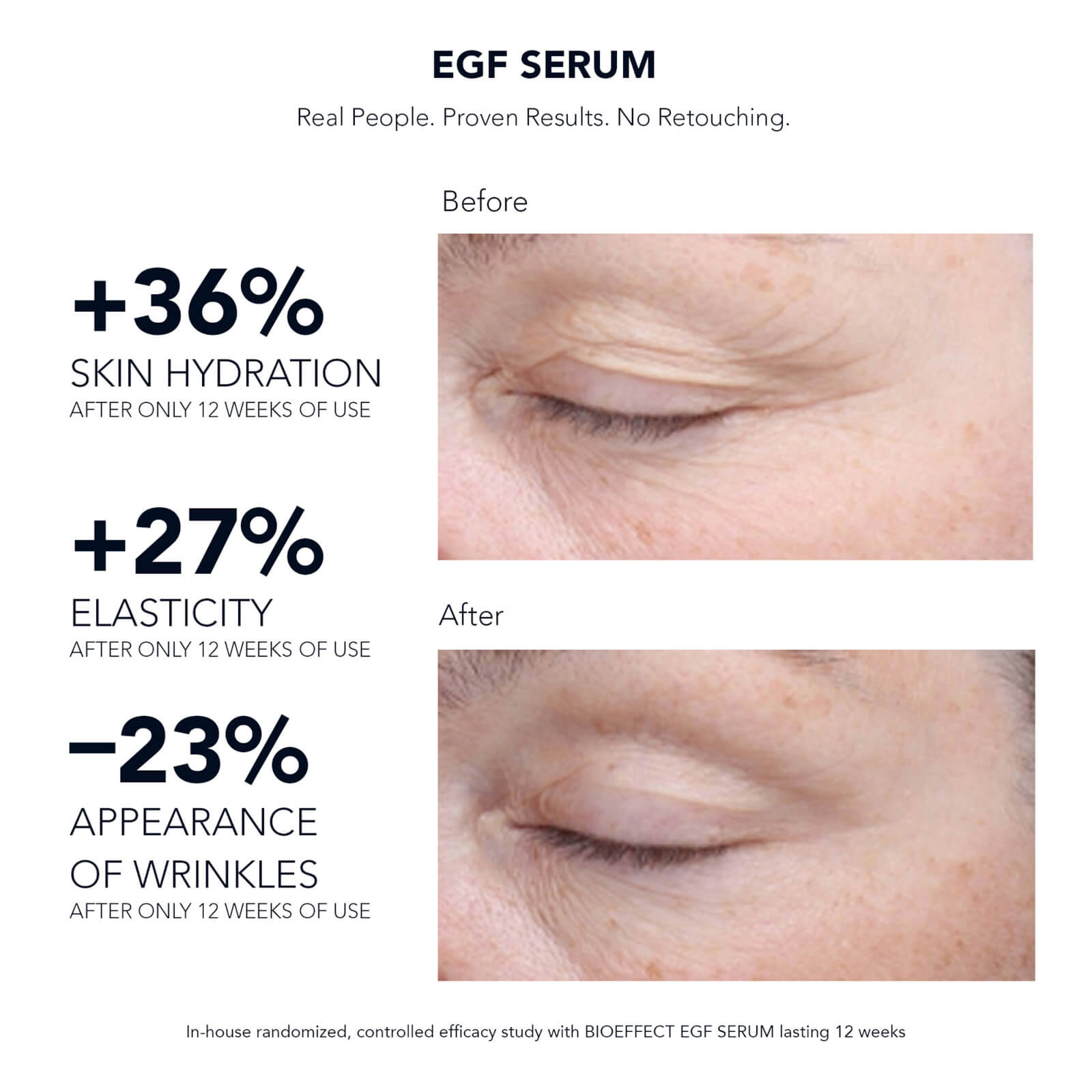 BIOEFFECT EGF Serum (Various Sizes) - 15ml