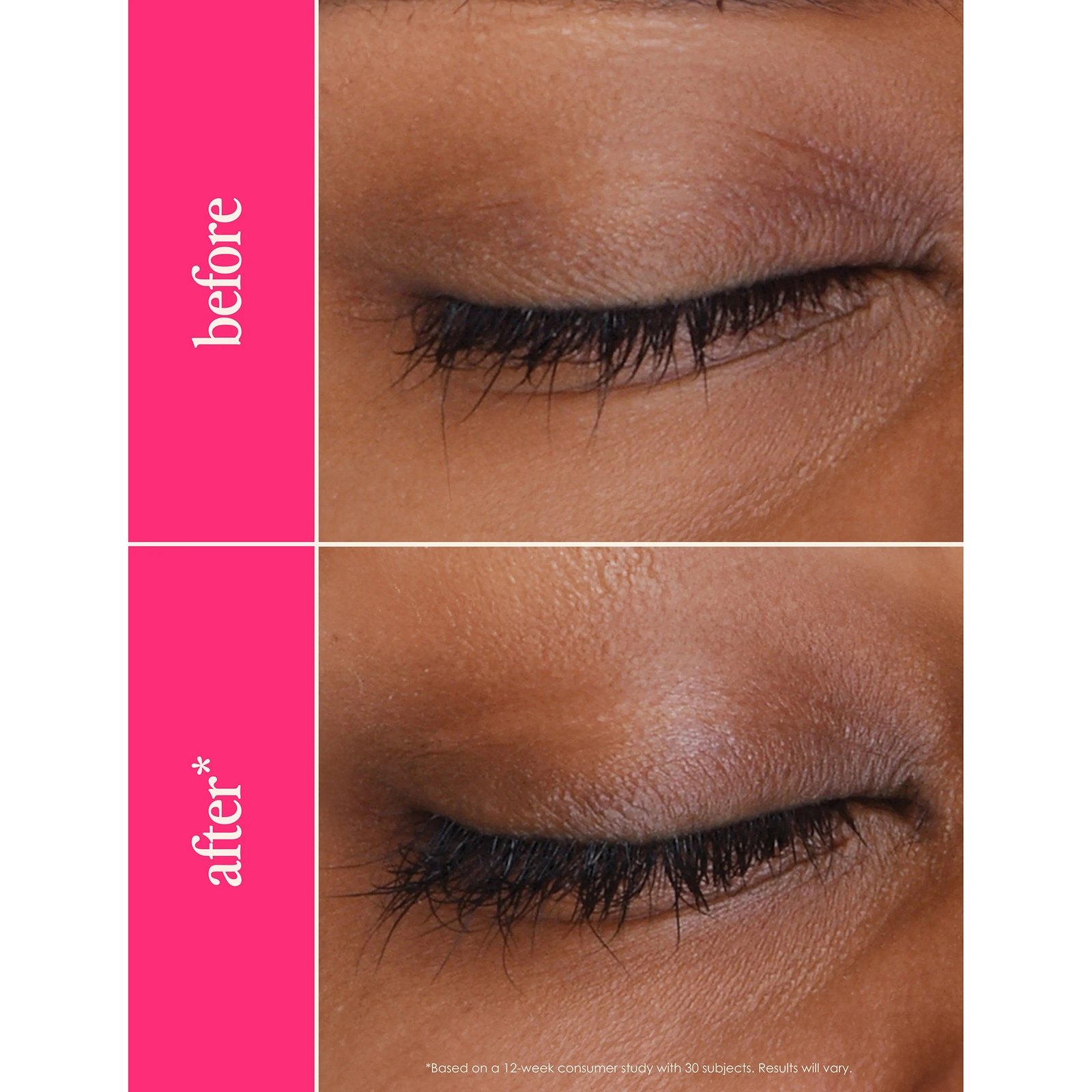 Thumbnail - GRANDE Cosmetics GrandeLASH-MD Wimpernvergrößerungsserum (verschiedene Optionen) - 3 Months Supply