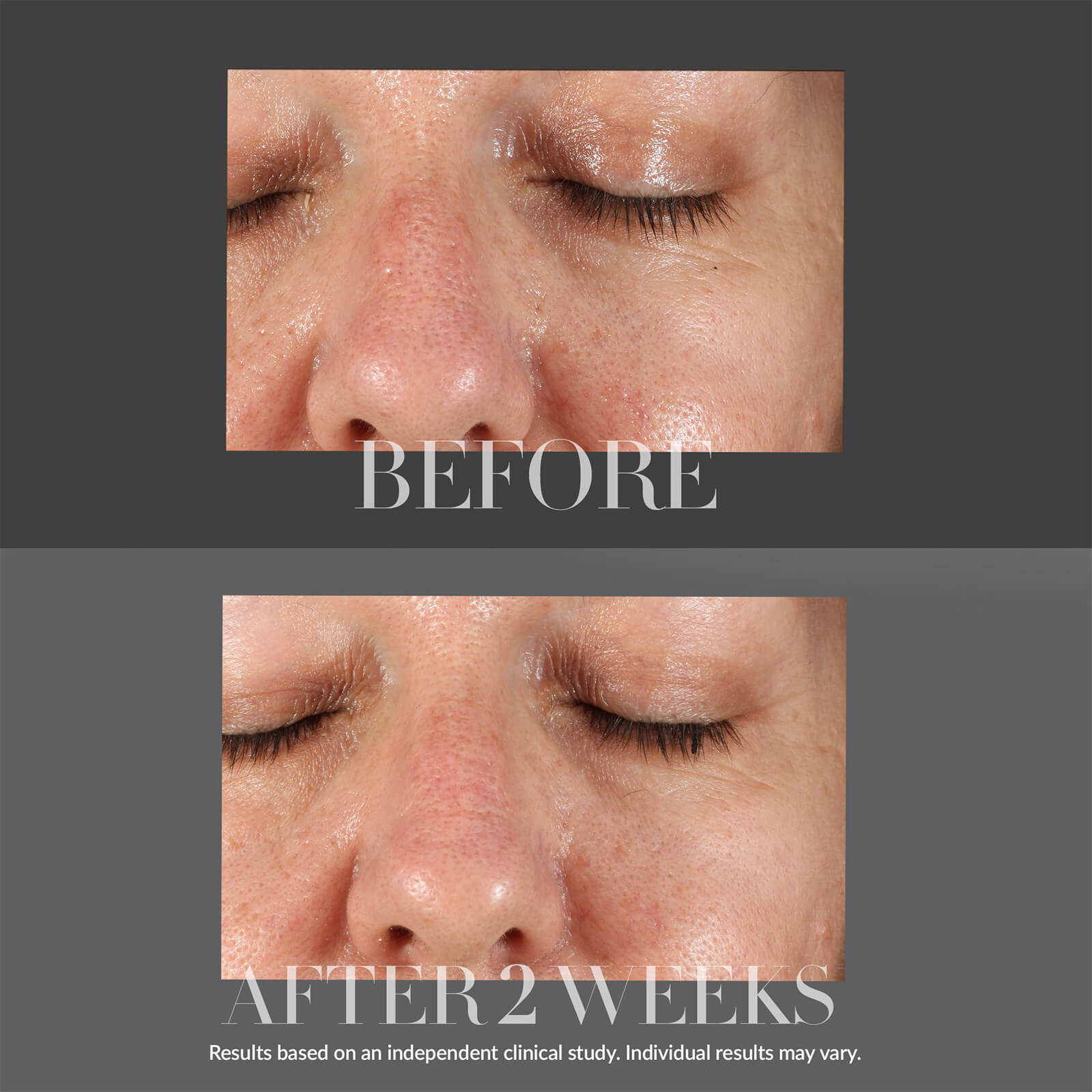 Thumbnail - Kate Somerville KateCeuticals Resurfacing Overnight Peel 30ml