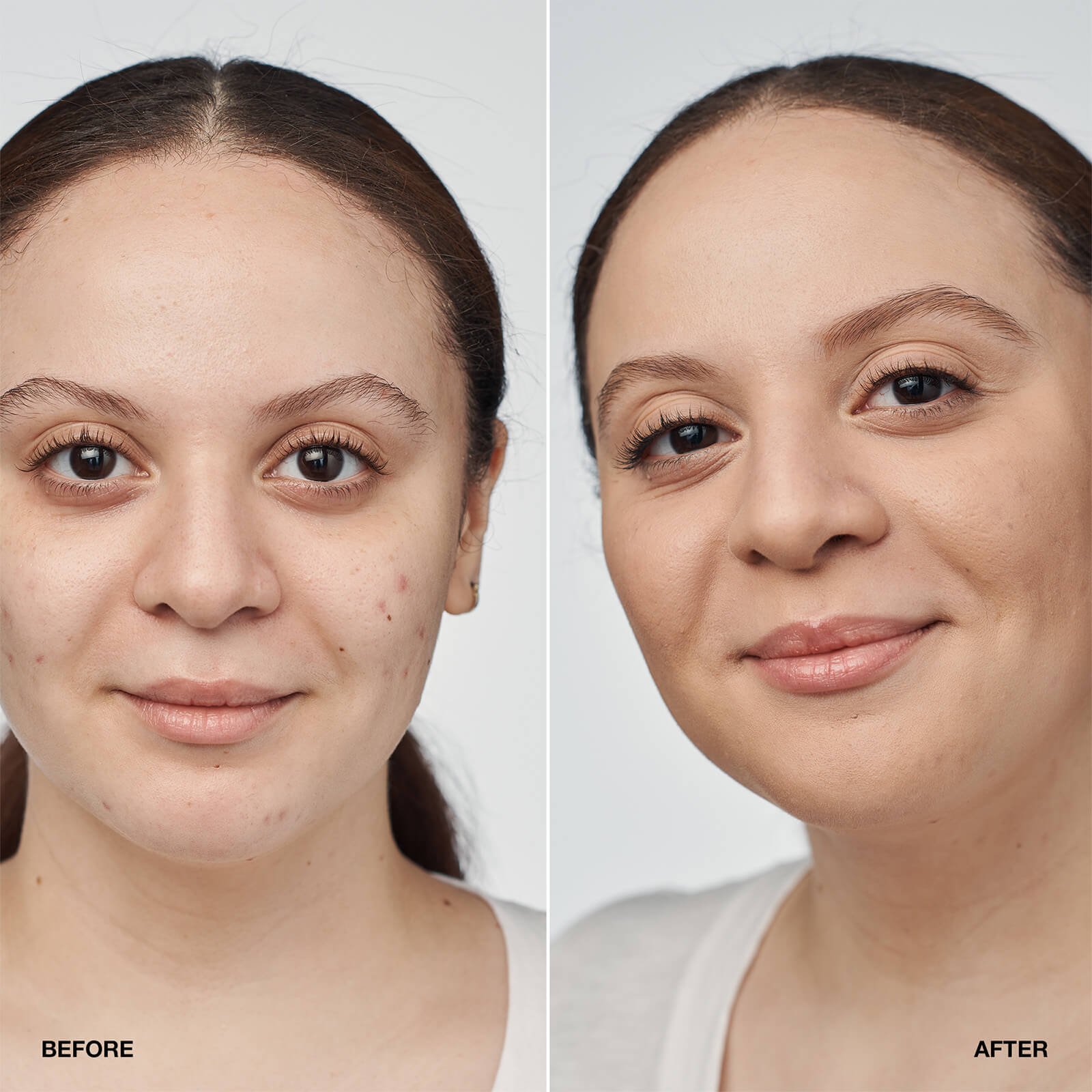 Thumbnail - Clinique Even Better Clinical Serum Foundation SPF20 30ml (Various Shades) - Neutral