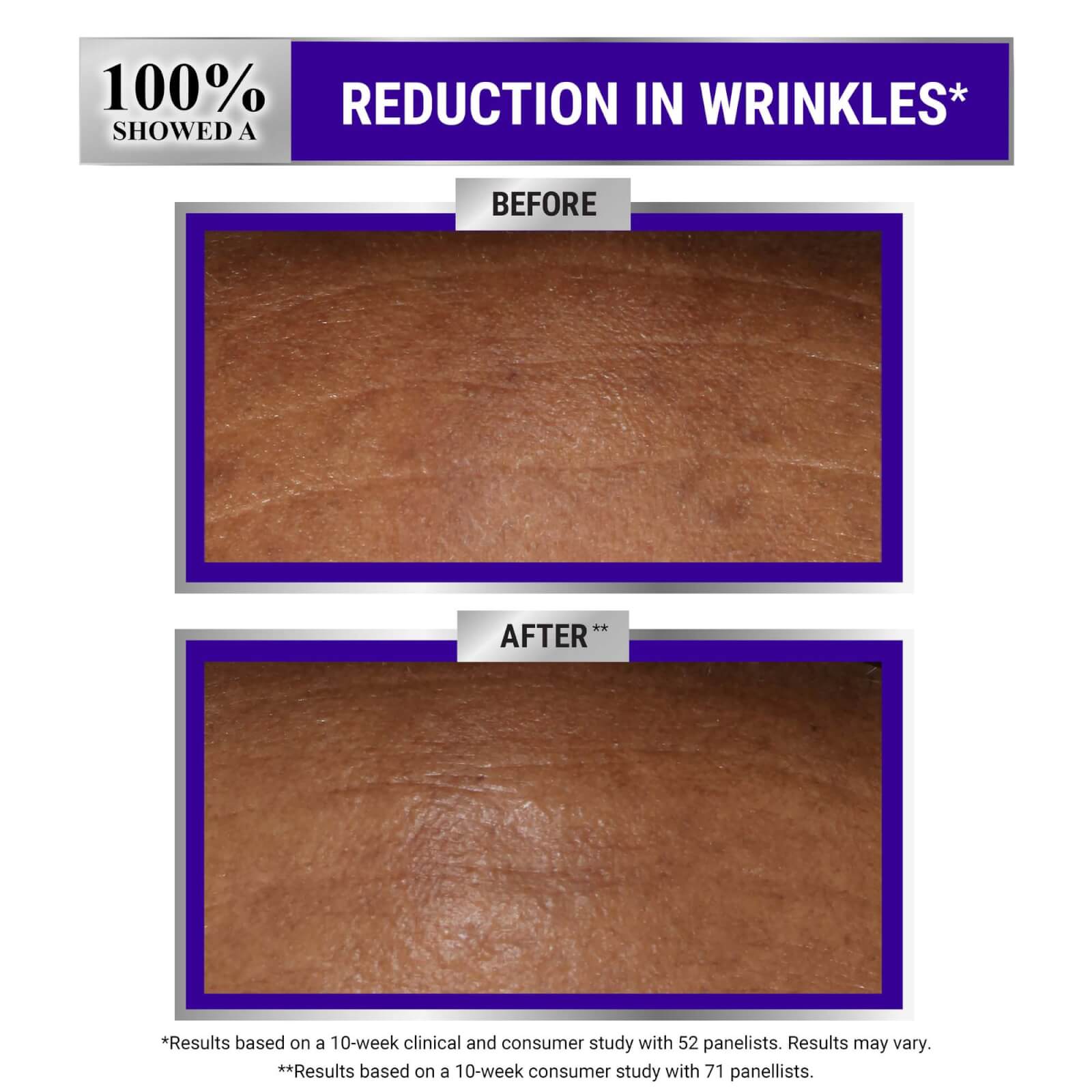 Thumbnail - Kiehl's Retinol Skin-Renewing Daily Micro-Dose Serum (Various Sizes) - 30ml