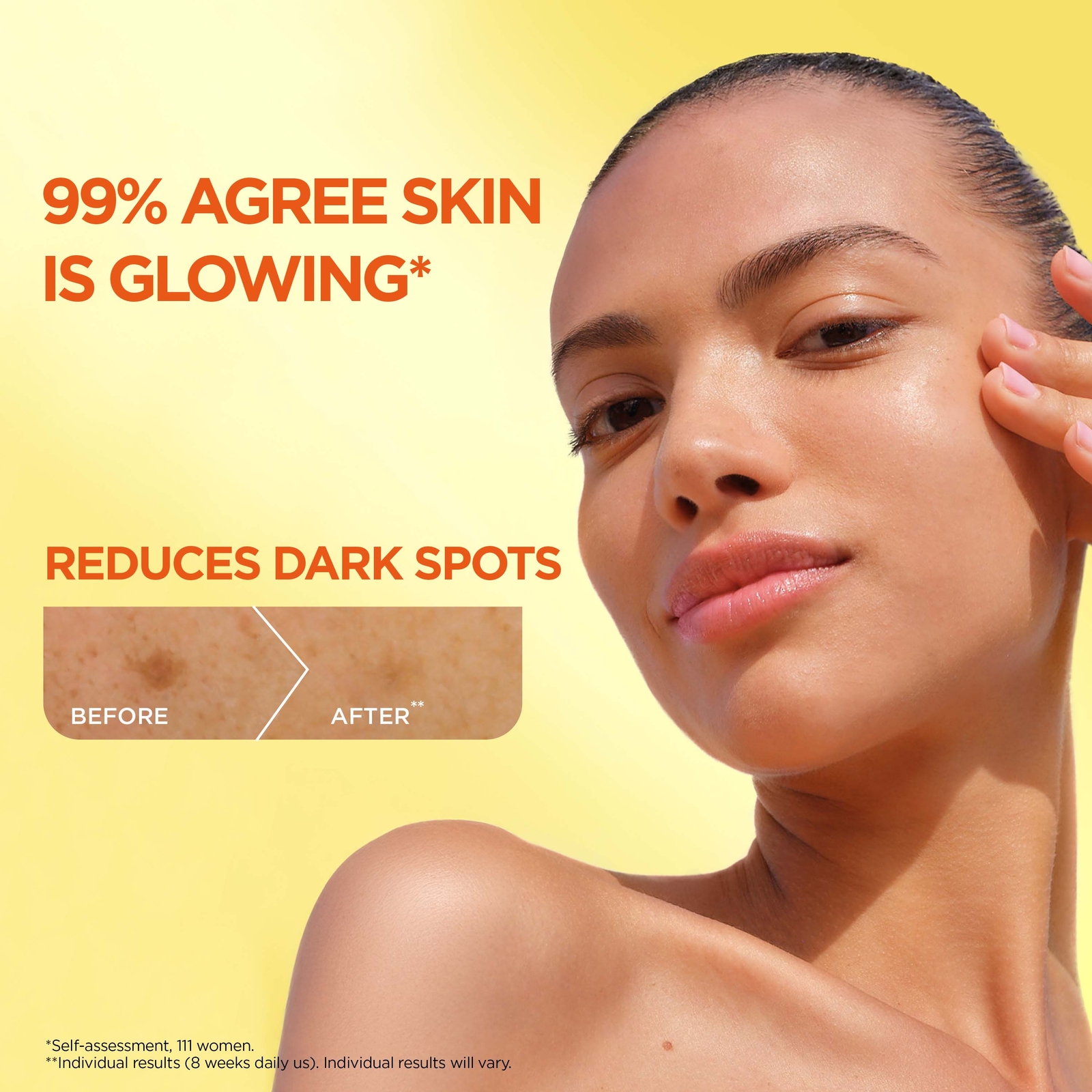 Thumbnail - Garnier 3.5% Vitamin C, Niacinamide, Salicylic Acid, Brightening and Anti Dark Spot Serum 30ml