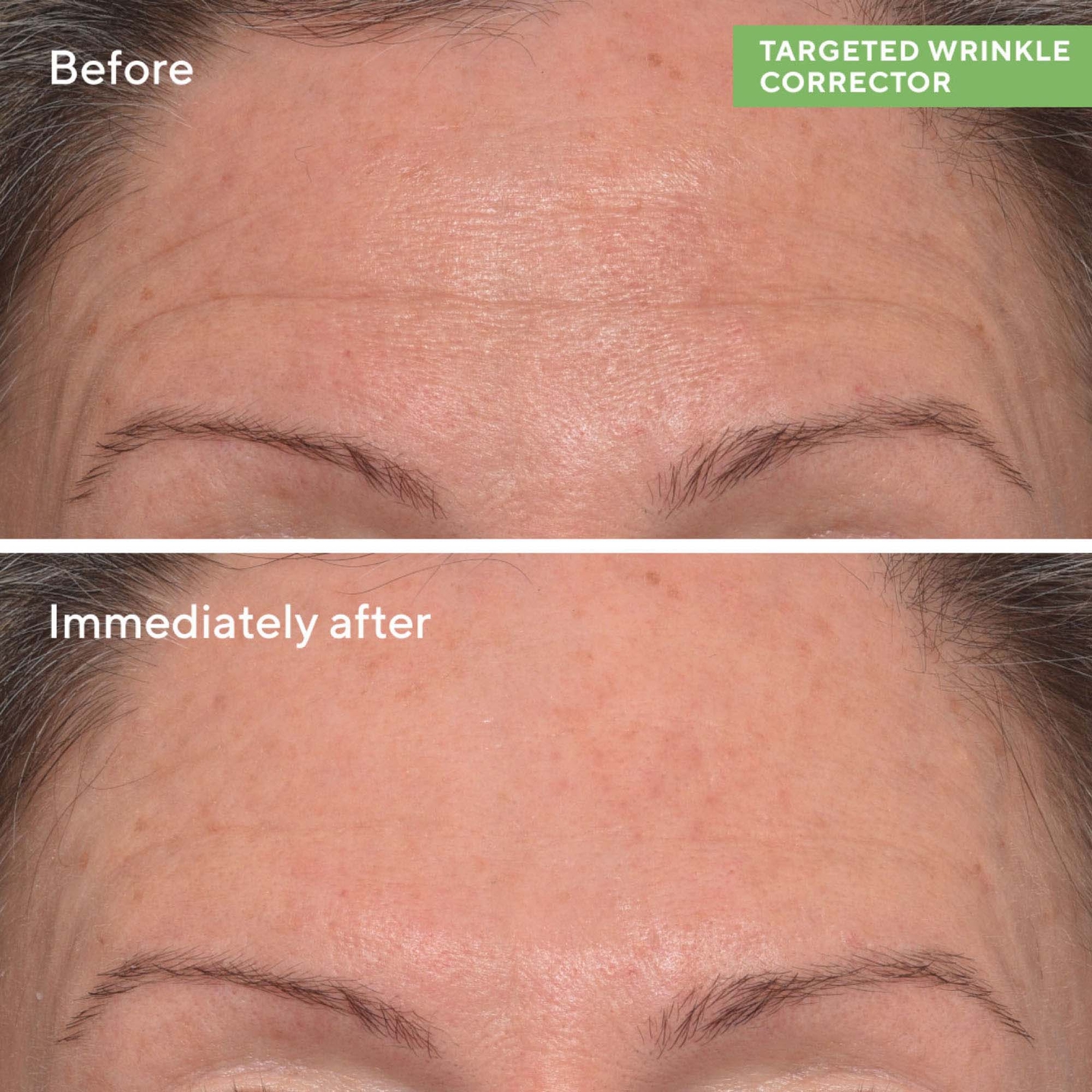 Thumbnail - Murad Targeted Wrinkle Corrector 15ml