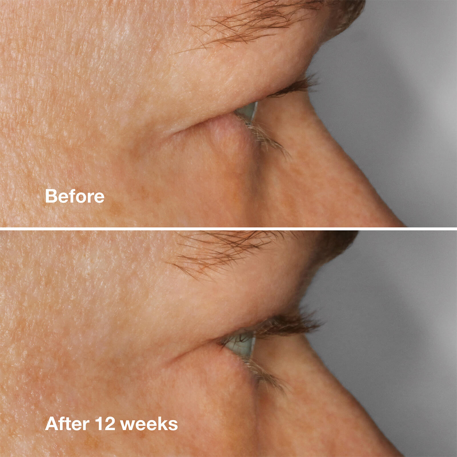 Thumbnail - Clinique High Impact Lash Amplifying Serum