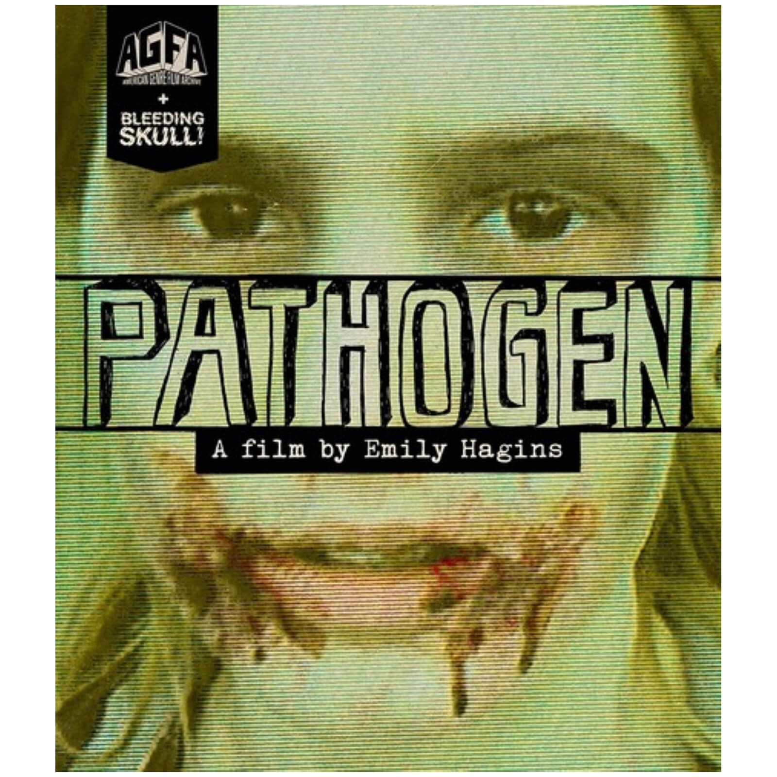 Pathogen (US Import)