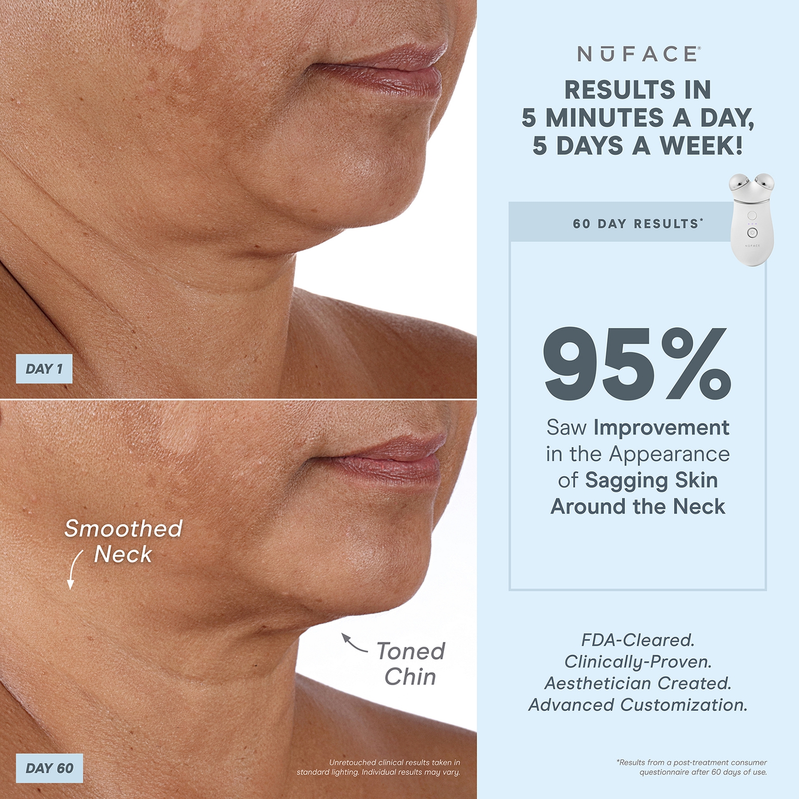 Thumbnail - NuFACE Trinity+ and Effective Lip and Eye Attachment Set