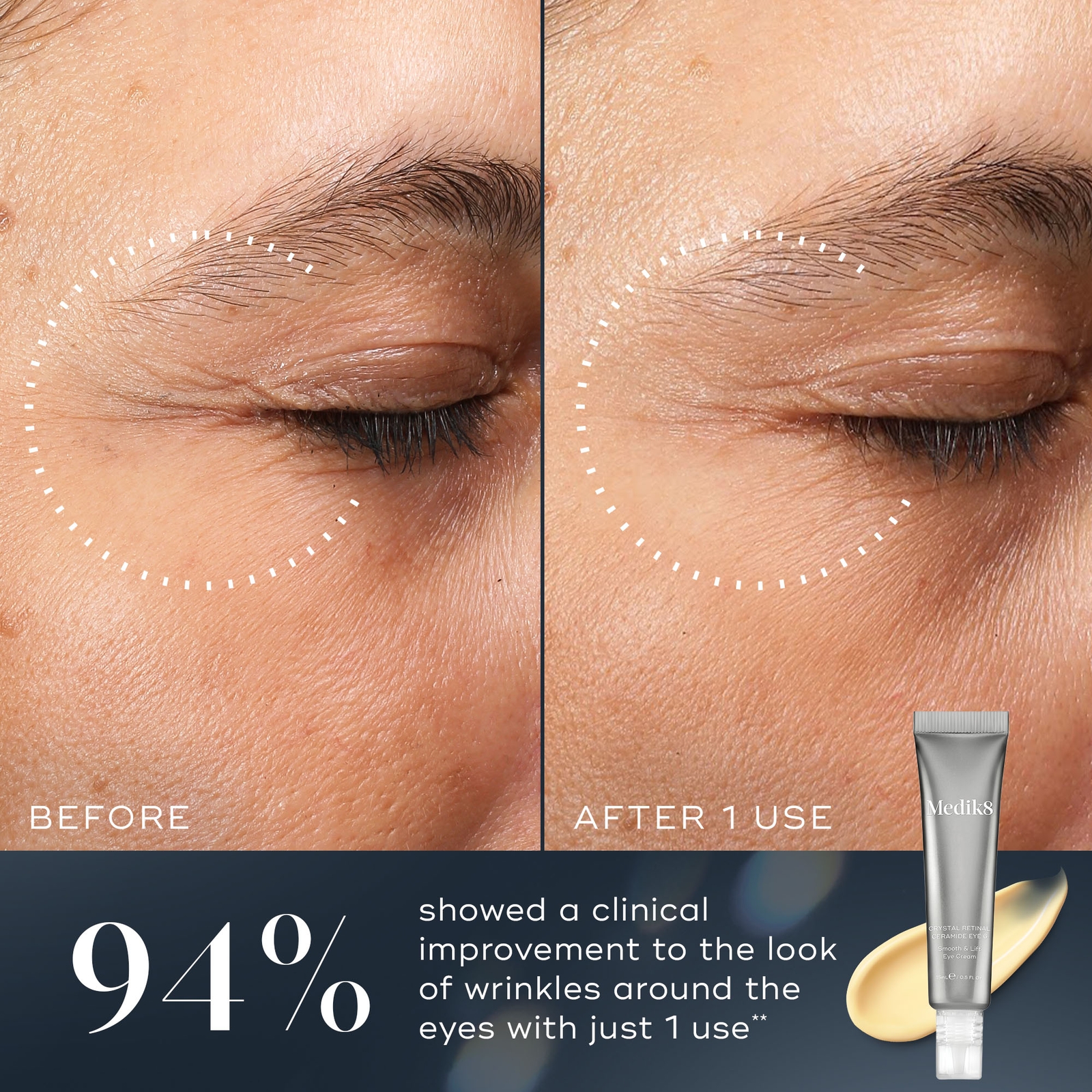 Thumbnail - Medik8 Crystal Retinal Ceramide Eye 10 15ml