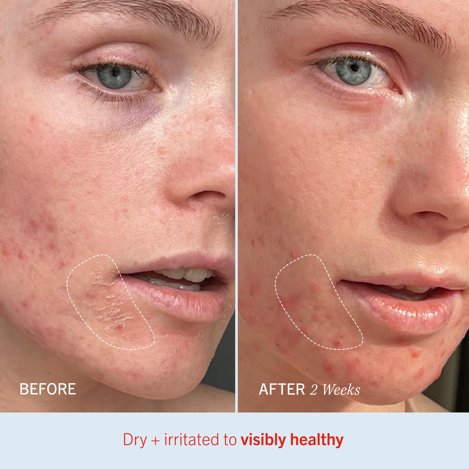 Thumbnail - First Aid Beauty Ultra Repair Cream 226g