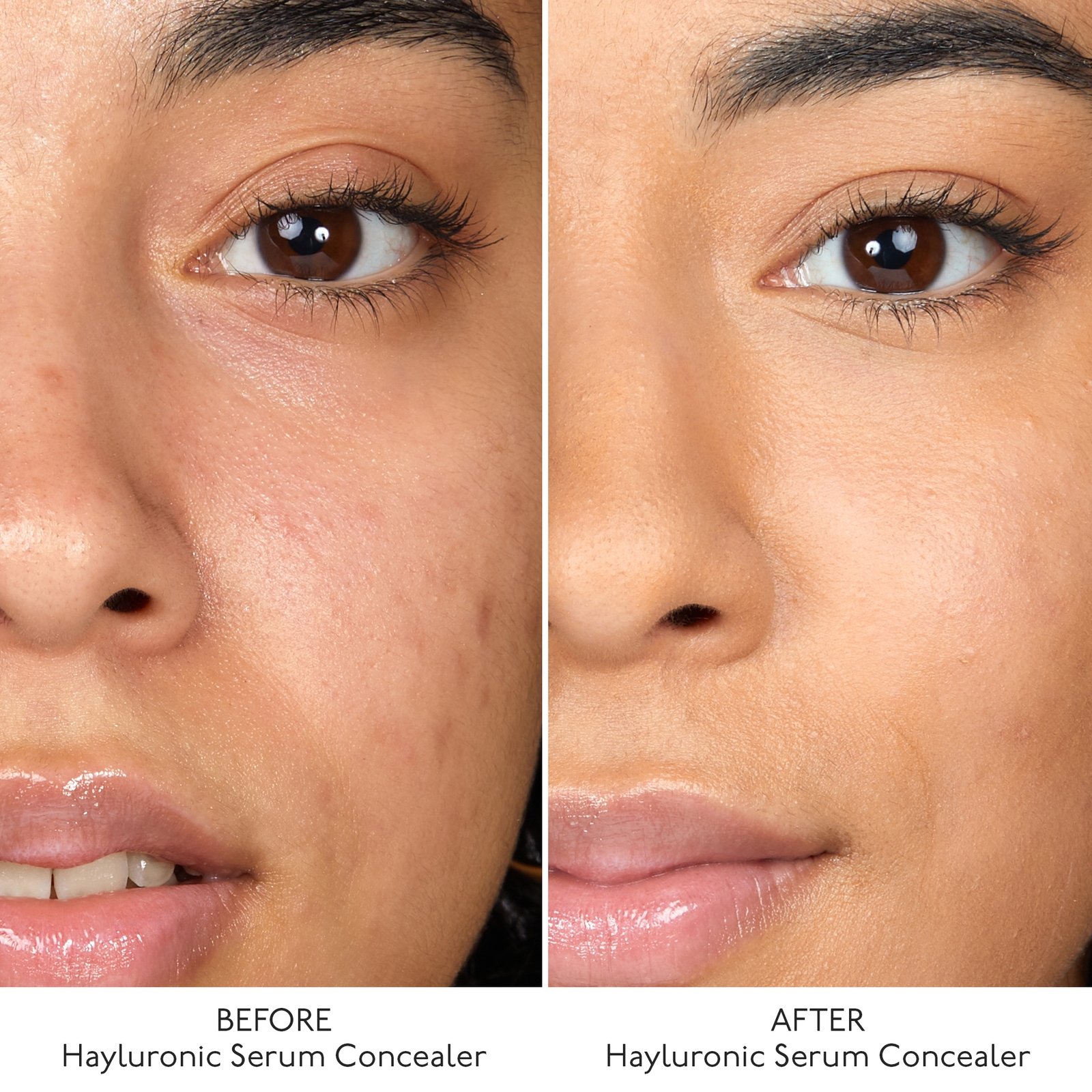Thumbnail - By Terry Hyaluronic Serum Concealer (Various Shades) - 6. Peach Beige