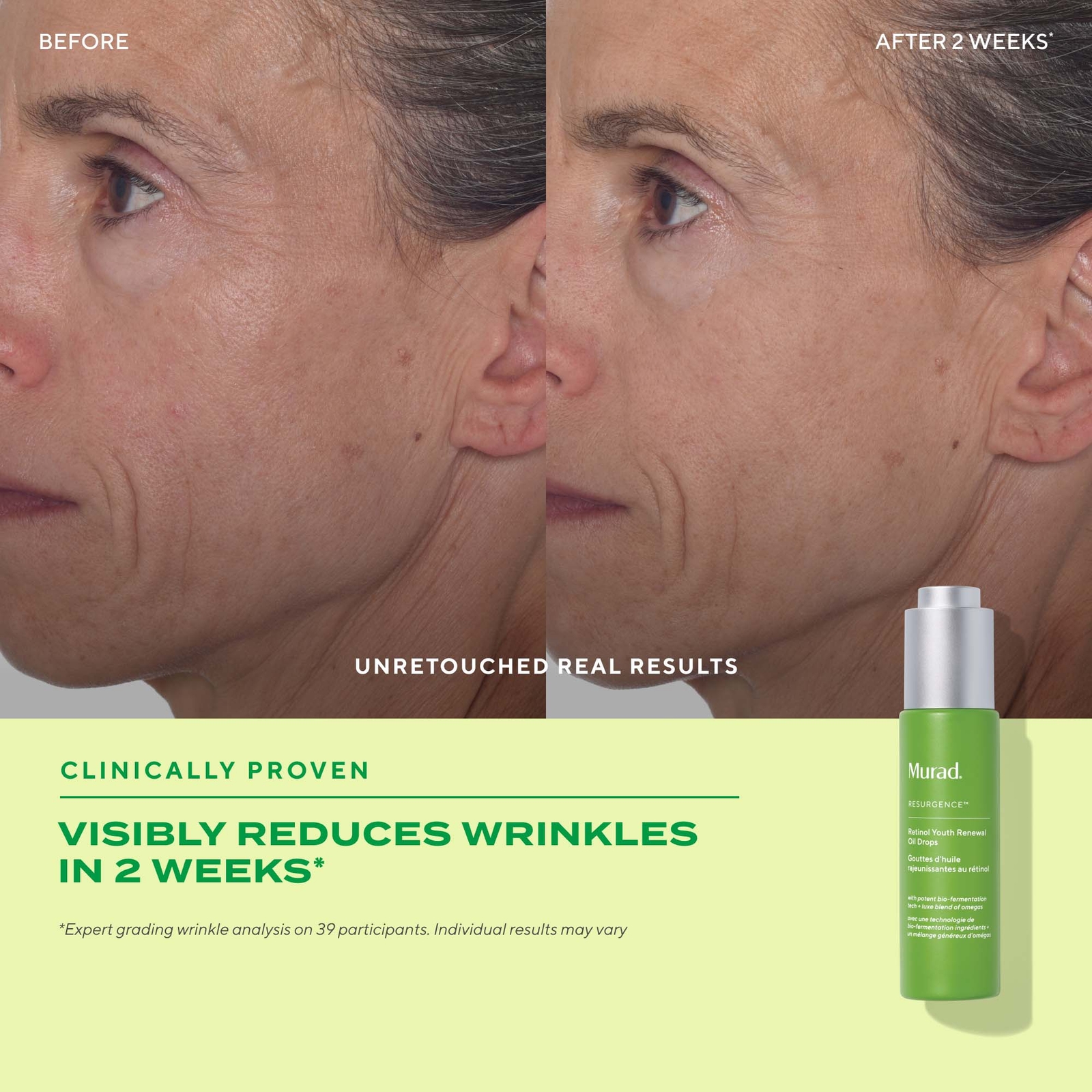 Thumbnail - Murad Retinol Youth Renewal Oil Drops 30ml