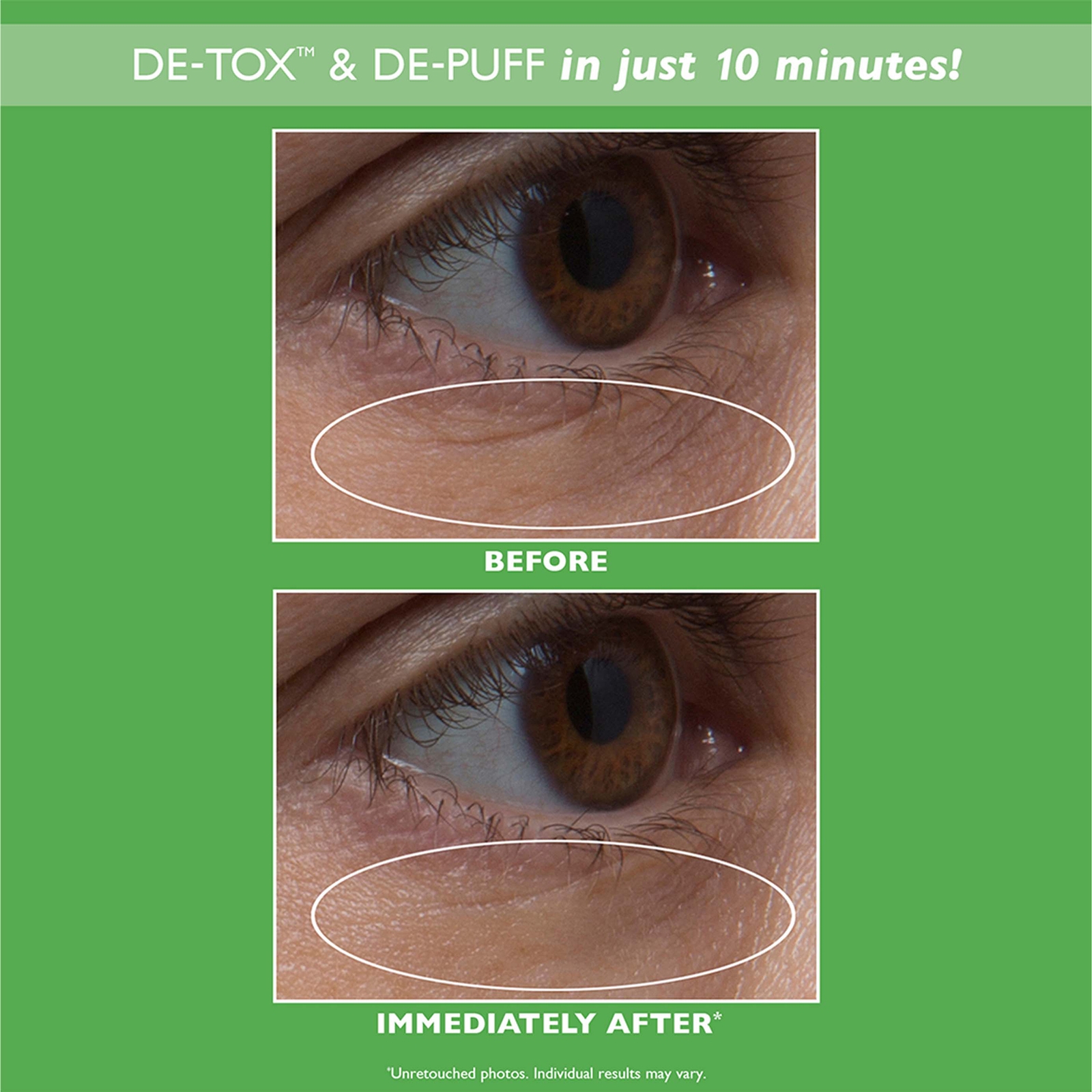 Thumbnail - Peter Thomas Roth Cucumber De-Tox Hydra-Gel Eye Patches 15 pairs