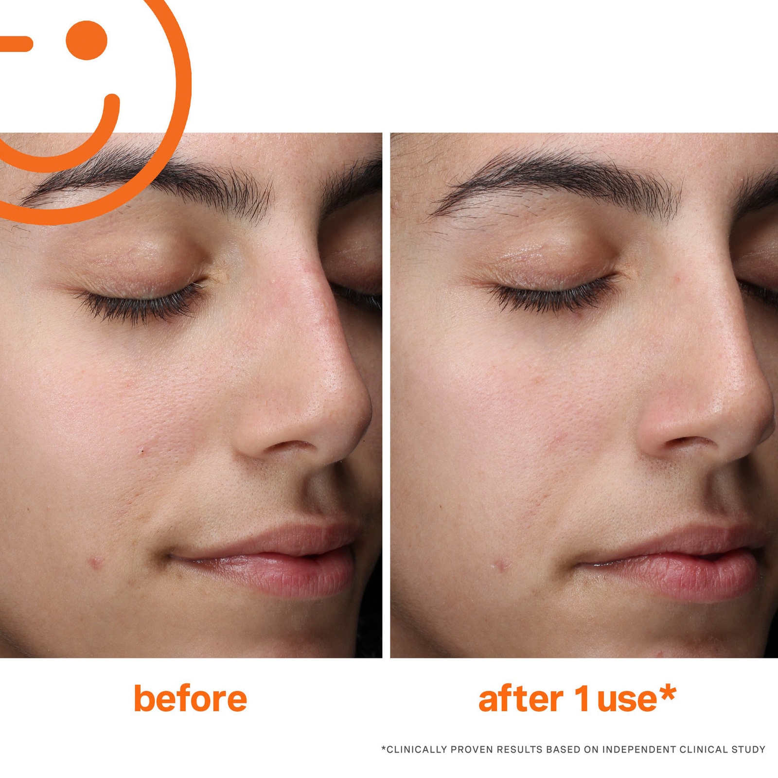 Thumbnail - Kate Somerville ExfoliKate Jumbo & Protect Duo