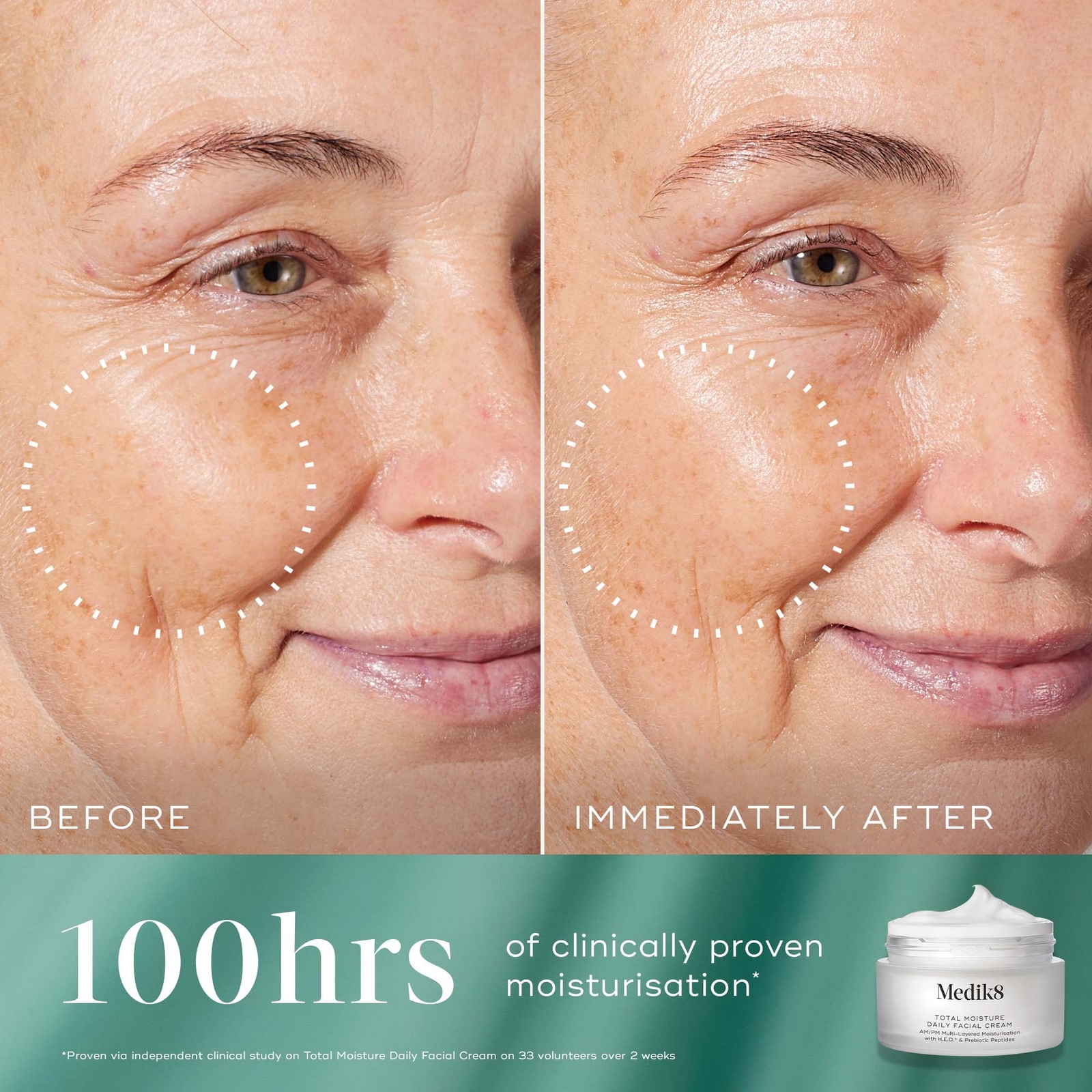 Thumbnail - Medik8 Hydration Heroes