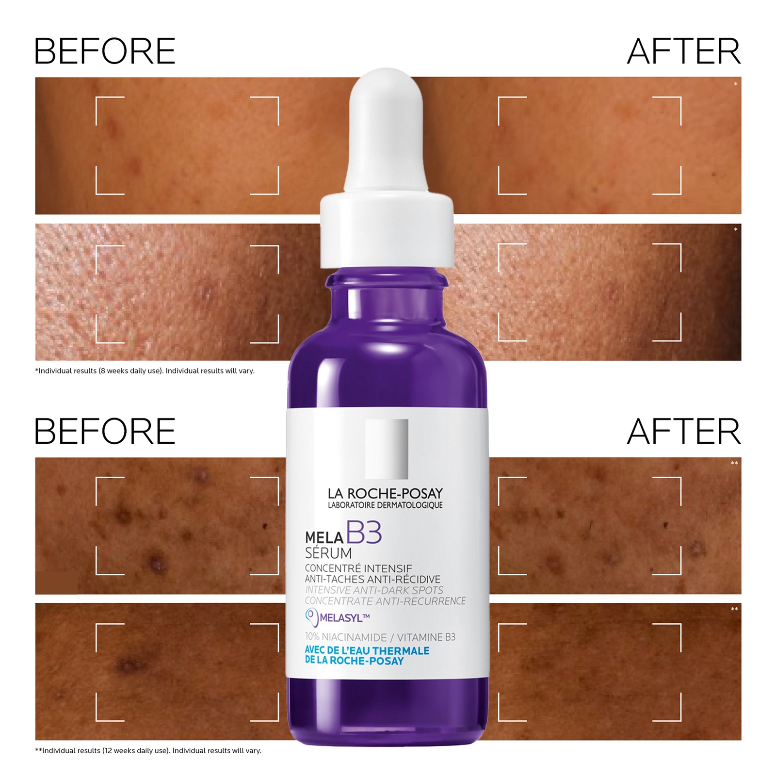Thumbnail - La Roche-Posay Anthelios Anti-Dark Spot Bundle