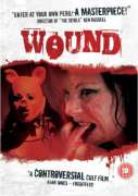 Wound