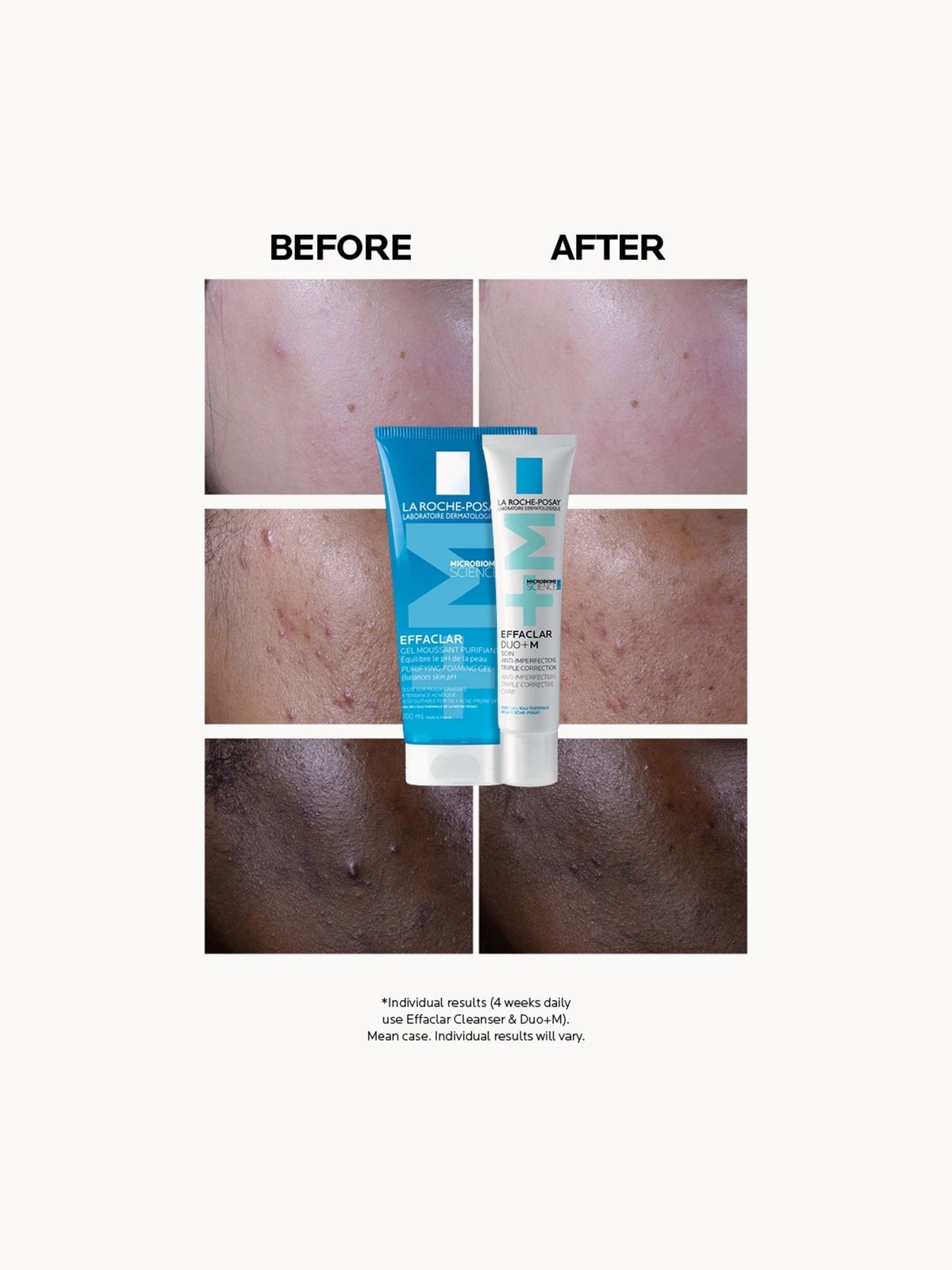 La Roche-Posay Effaclar Duo+M Anti-Blemish Corrective Gel Moisturiser for Oily, Blemish-Prone Skin 40ml 2
