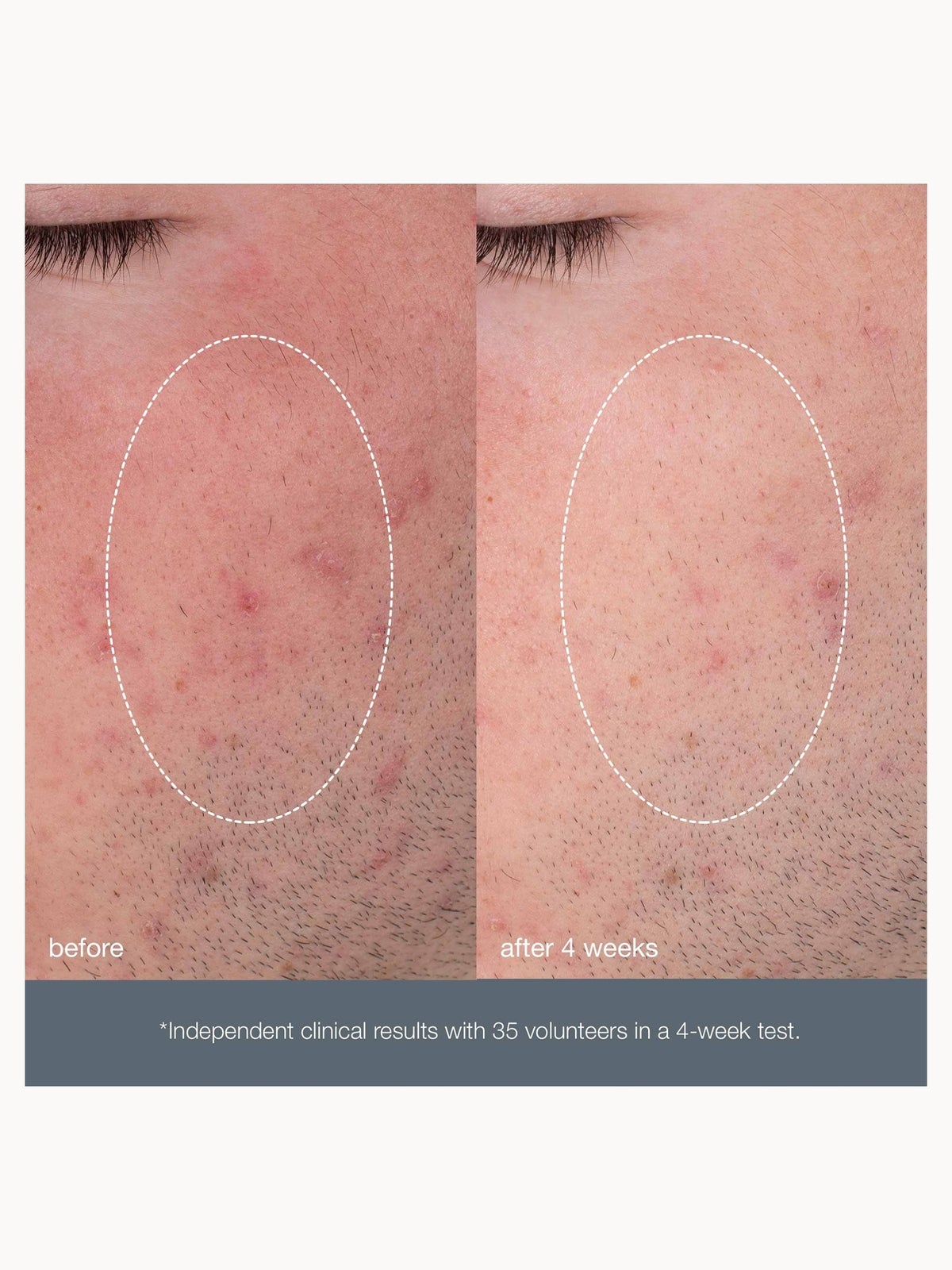 Dermalogica Daily Microfoliant 13g, photo 3