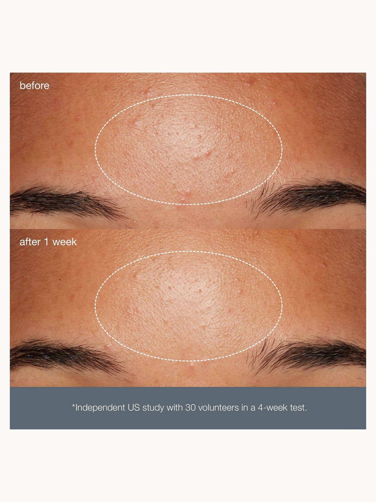 Dermalogica Daily Microfoliant 13g, photo 4