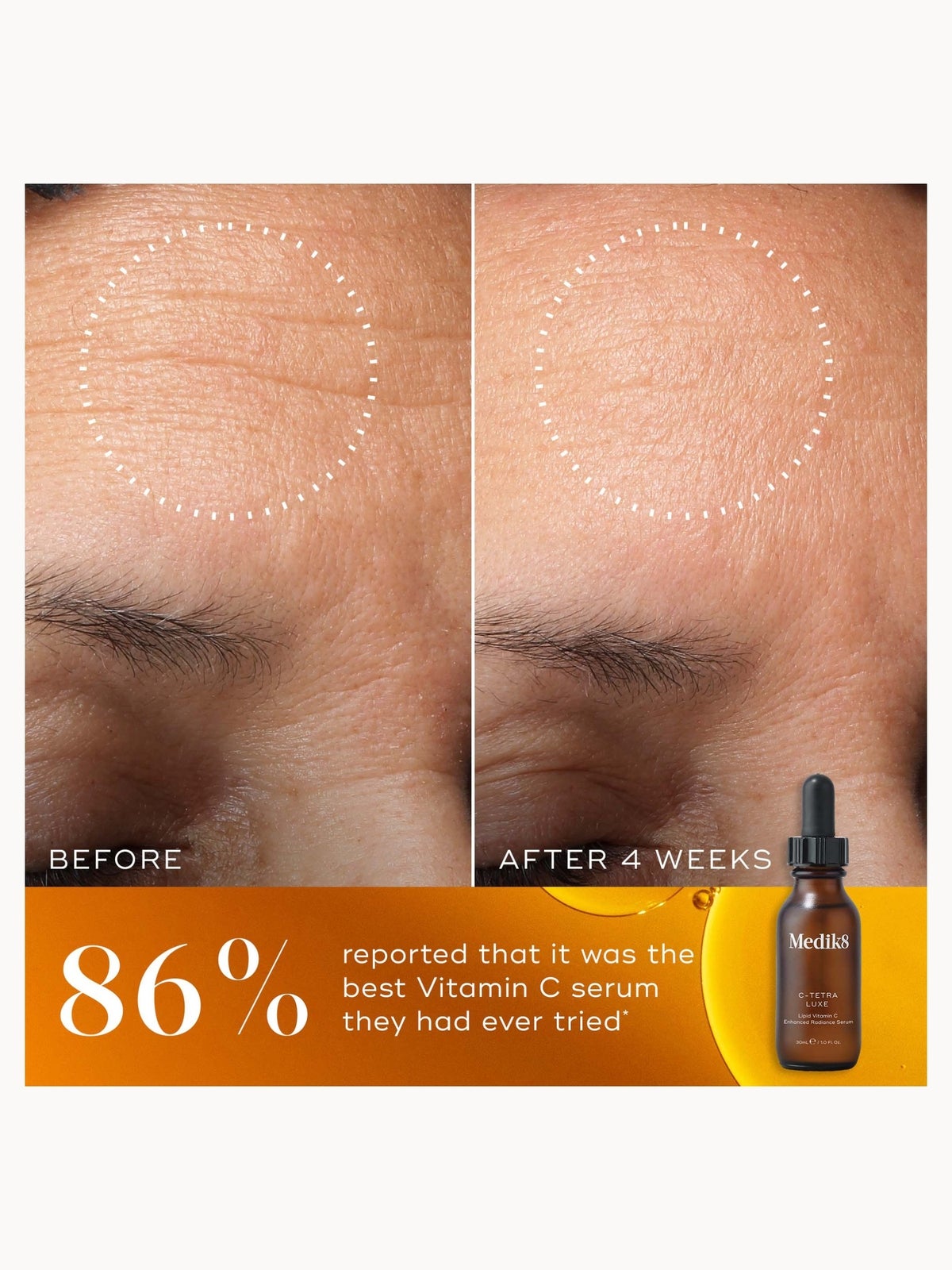 Medik8 C-Tetra Luxe 30ml 3