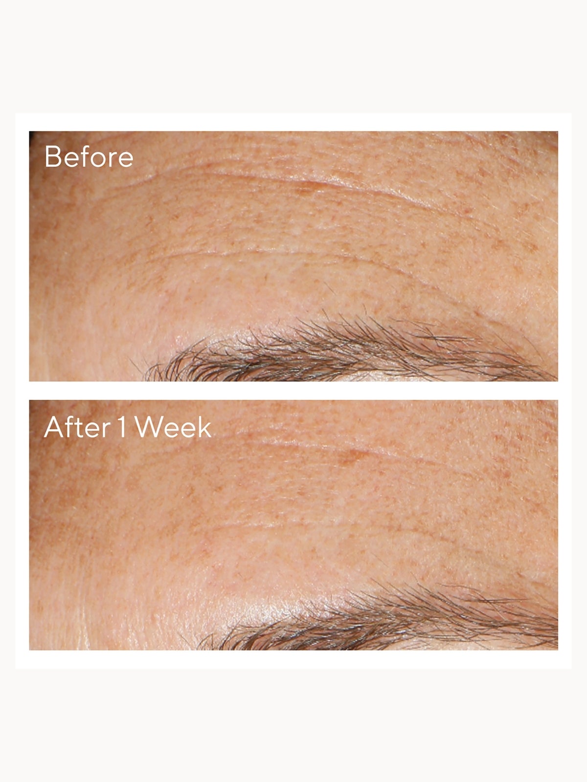 Murad Replenishing Multi-Acid Peel 100ml 3