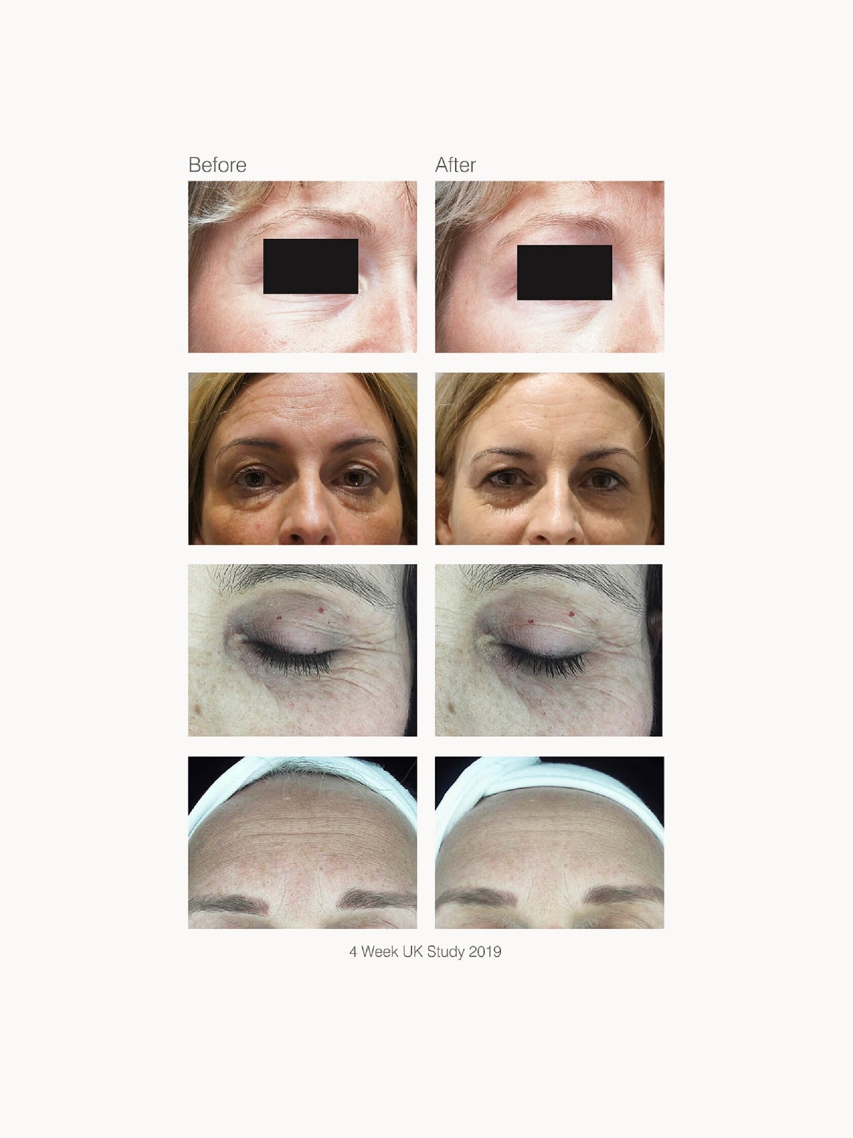 Rio FaceLite Beauty Boosting LED Face Mask 4