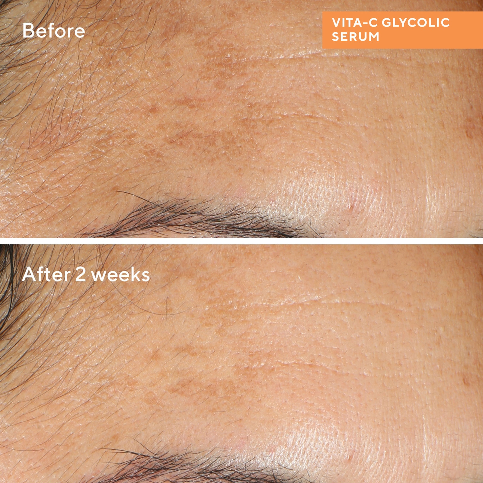 Murad Vita-C Glycolic Brightening Serum 30ml