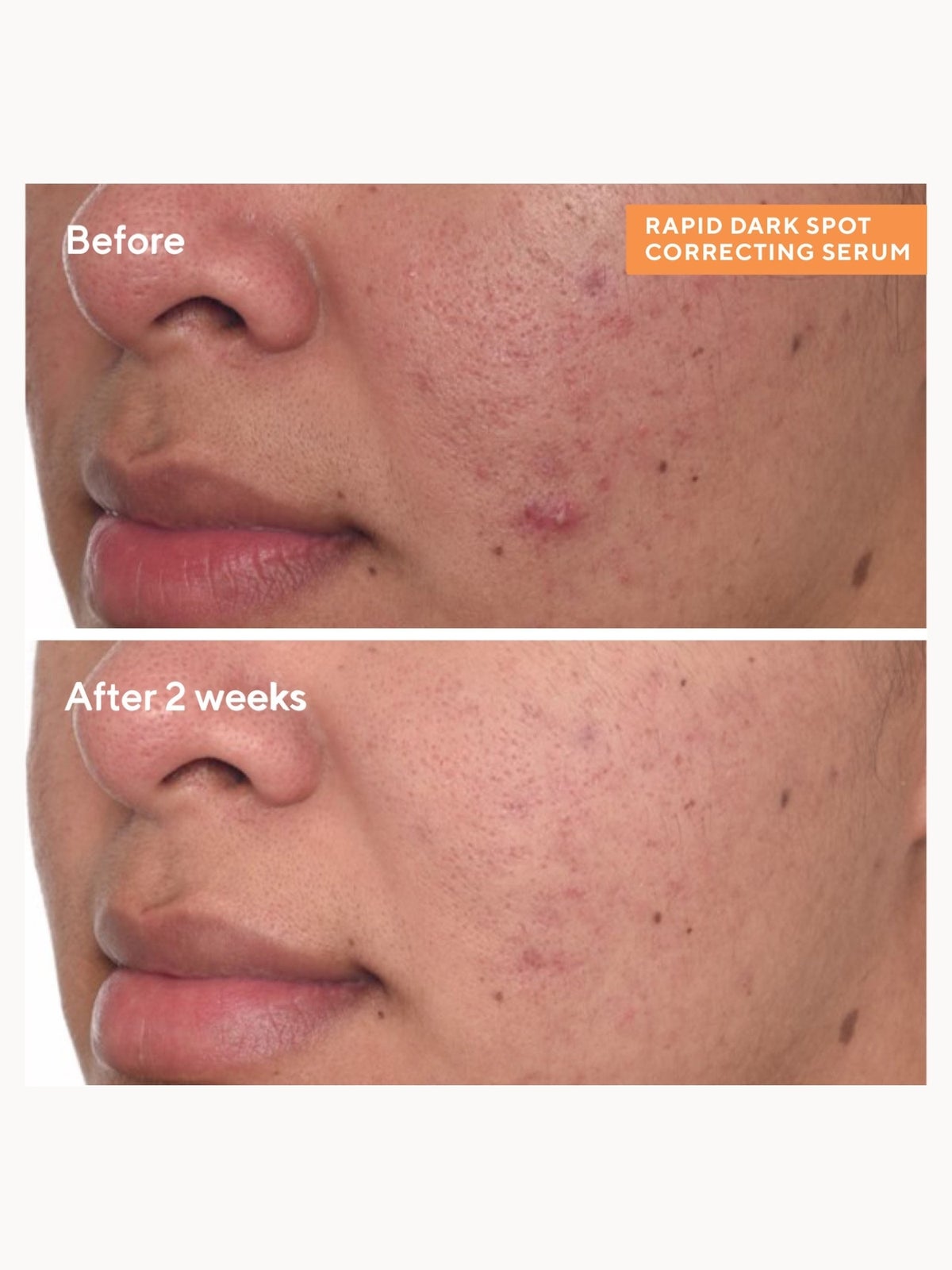 Murad Rapid Dark Spot Correcting Serum 30ml 2