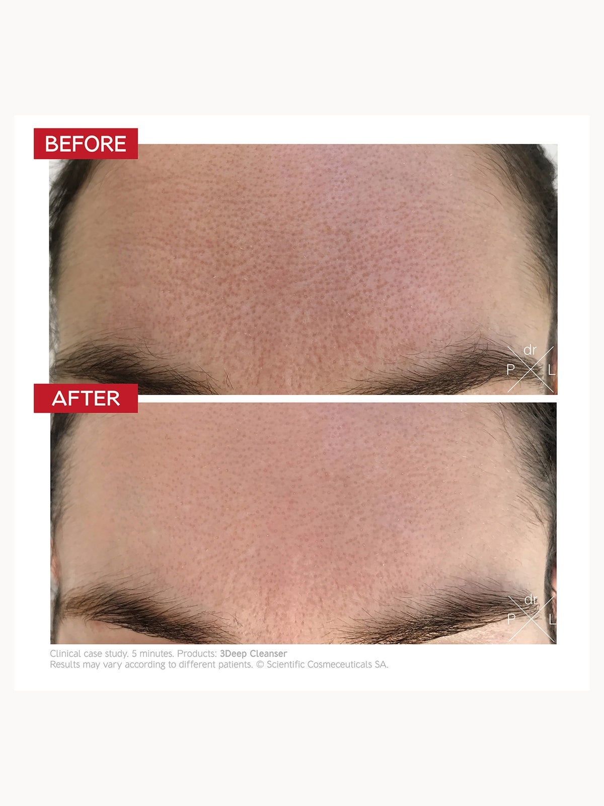 Dr. LEVY Switzerland 3Deep Cell Renewal Micro-Resurfacing Cleanser 150ml 3