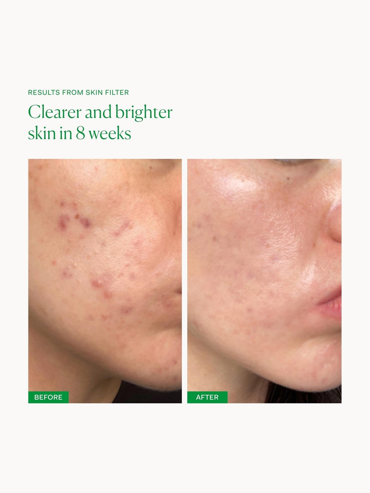 The Nue Co. Skin Filter (30 capsules) 3