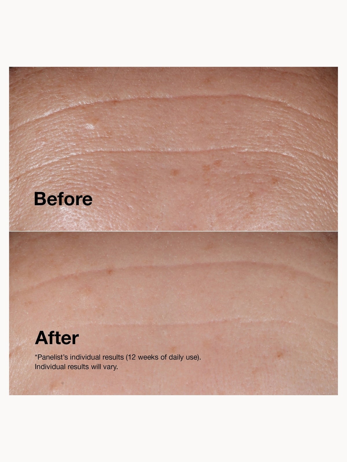 Clinique Smart Clinical Repair Wrinkle Correcting Serum (Various Sizes), photo 11