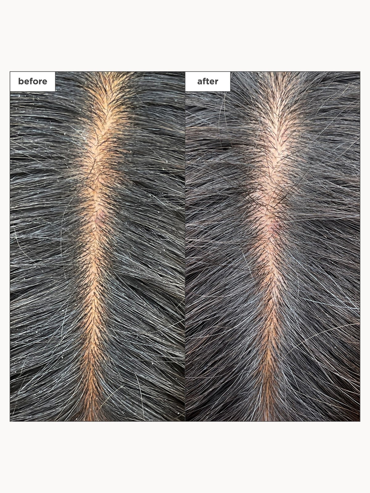 Briogeo Scalp Revival Charcoal + Tea Tree Cooling Hydration Scalp Mask for Dry, Itchy Scalp 177ml 2