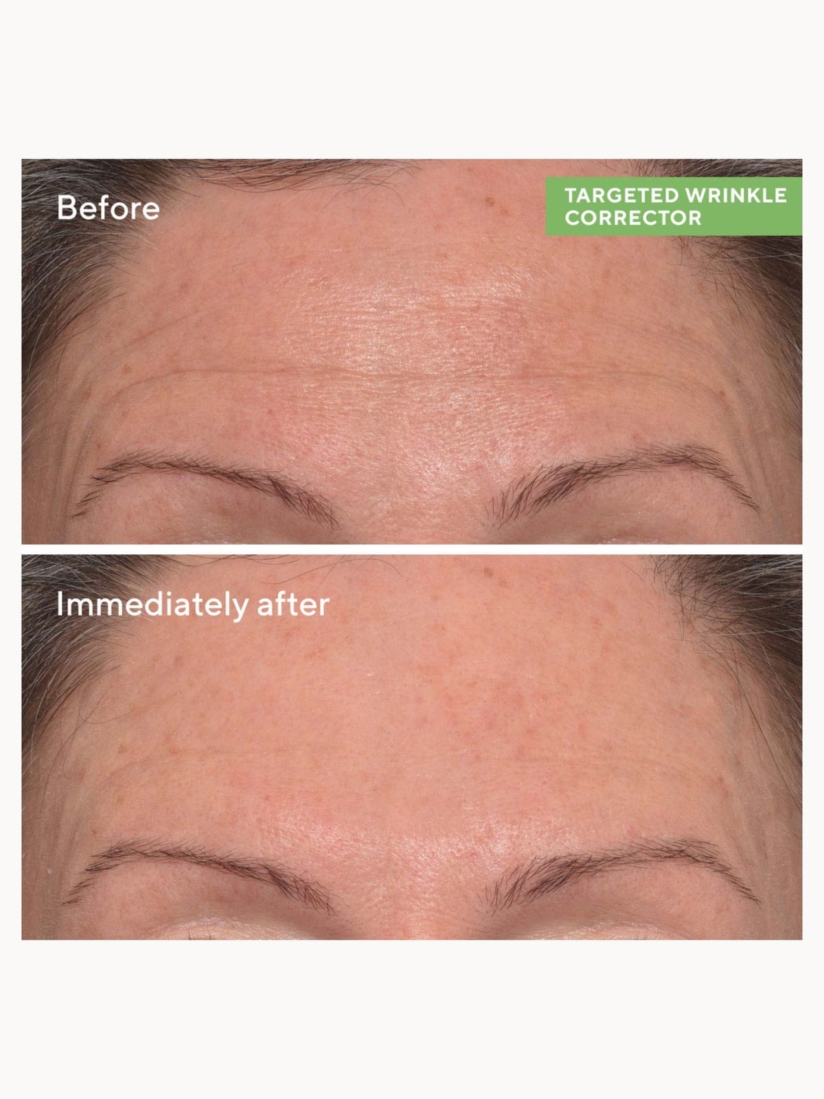 Murad Targeted Wrinkle Corrector 15ml 3