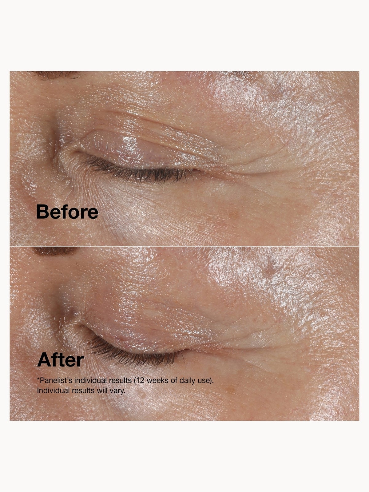 Clinique Smart Clinical Repair Wrinkle Correcting Eye Cream 15ml 3