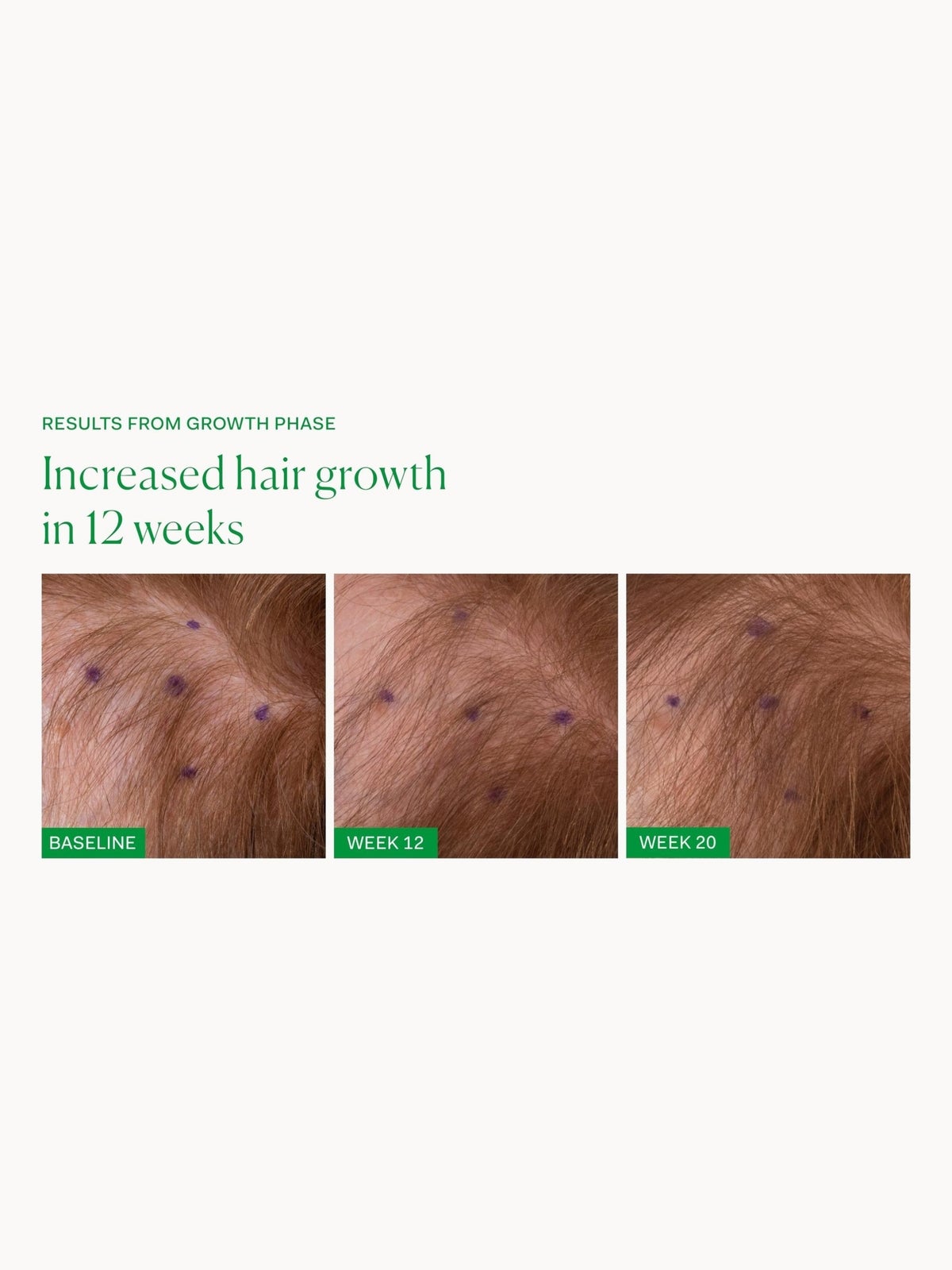 The Nue Co. Growth Phase Hair Supplements (90 Capsules) 2