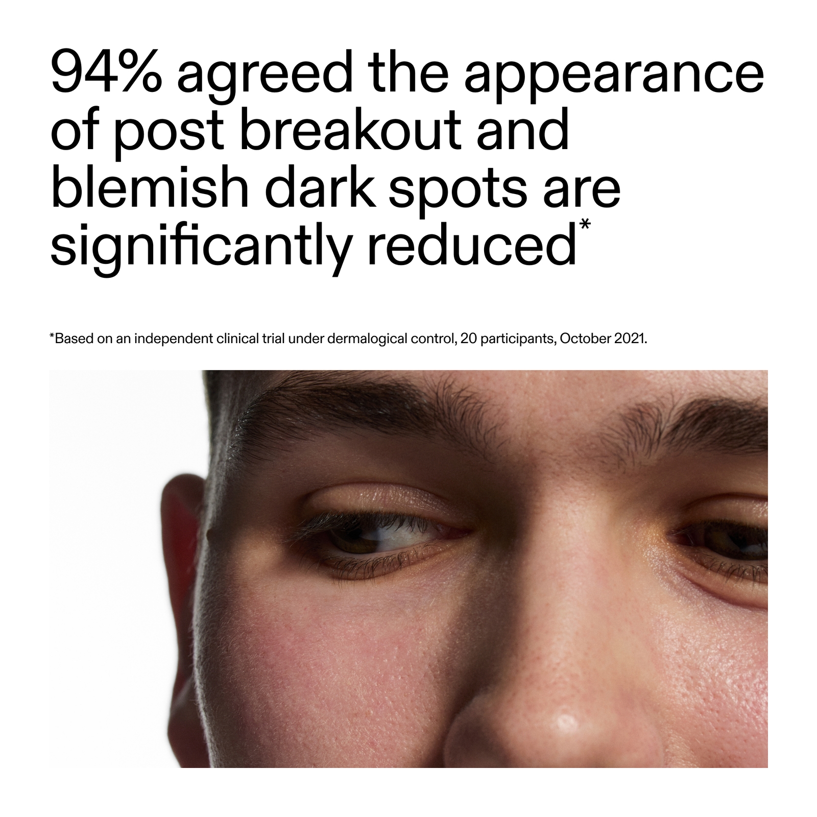 Thumbnail - The INKEY List Mandelic Acid Treatment 15ml