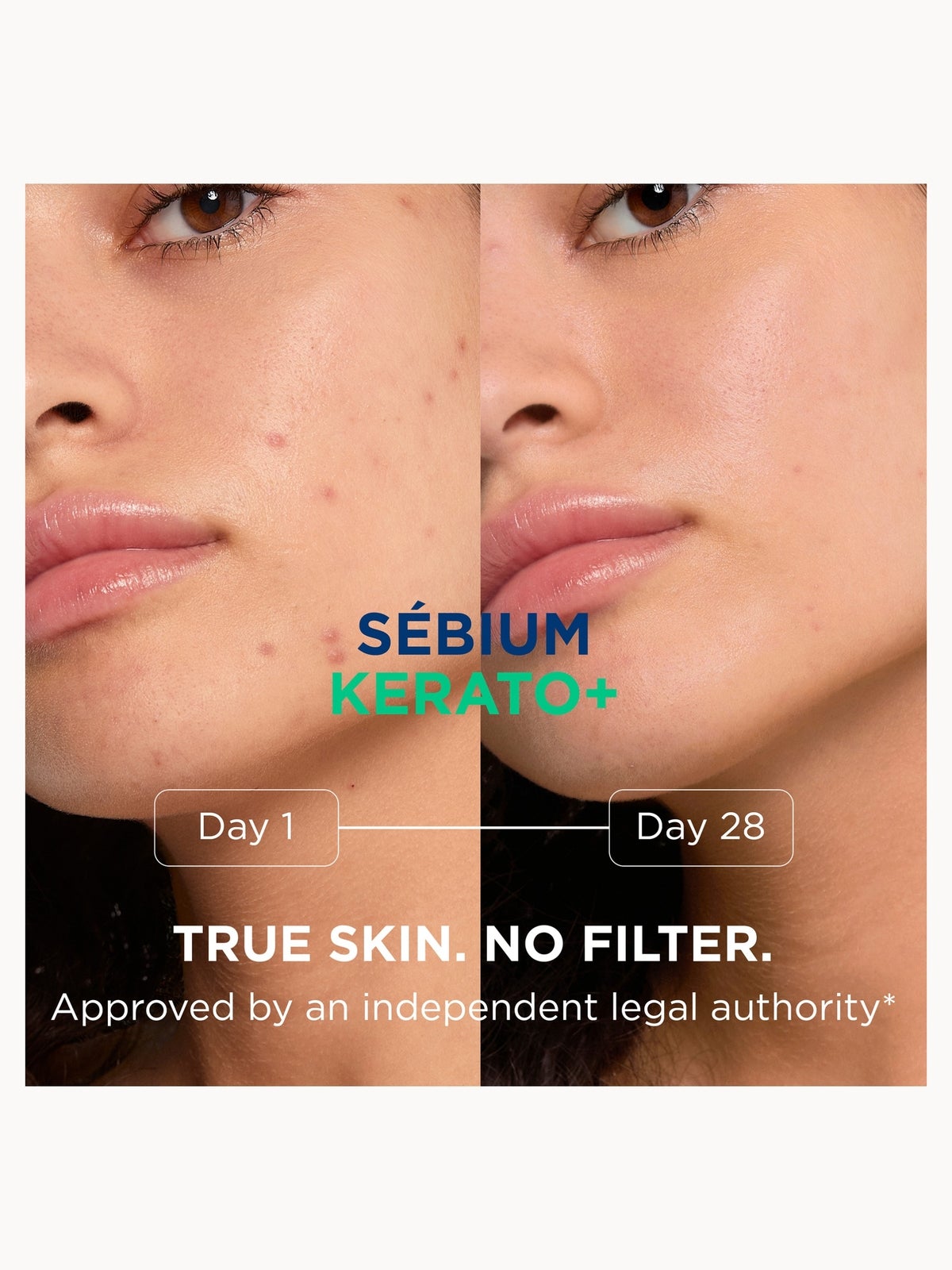 Bioderma Sebium Kerato+ Anti-Blemish Gel-Cream 30ml 4