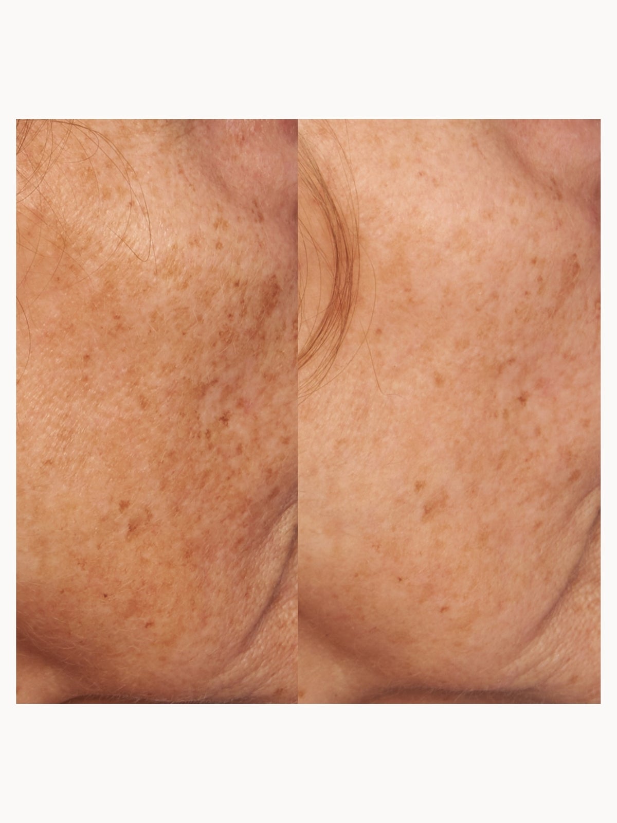 Perricone MD VCE Intensive Dark Spot Treatment 4