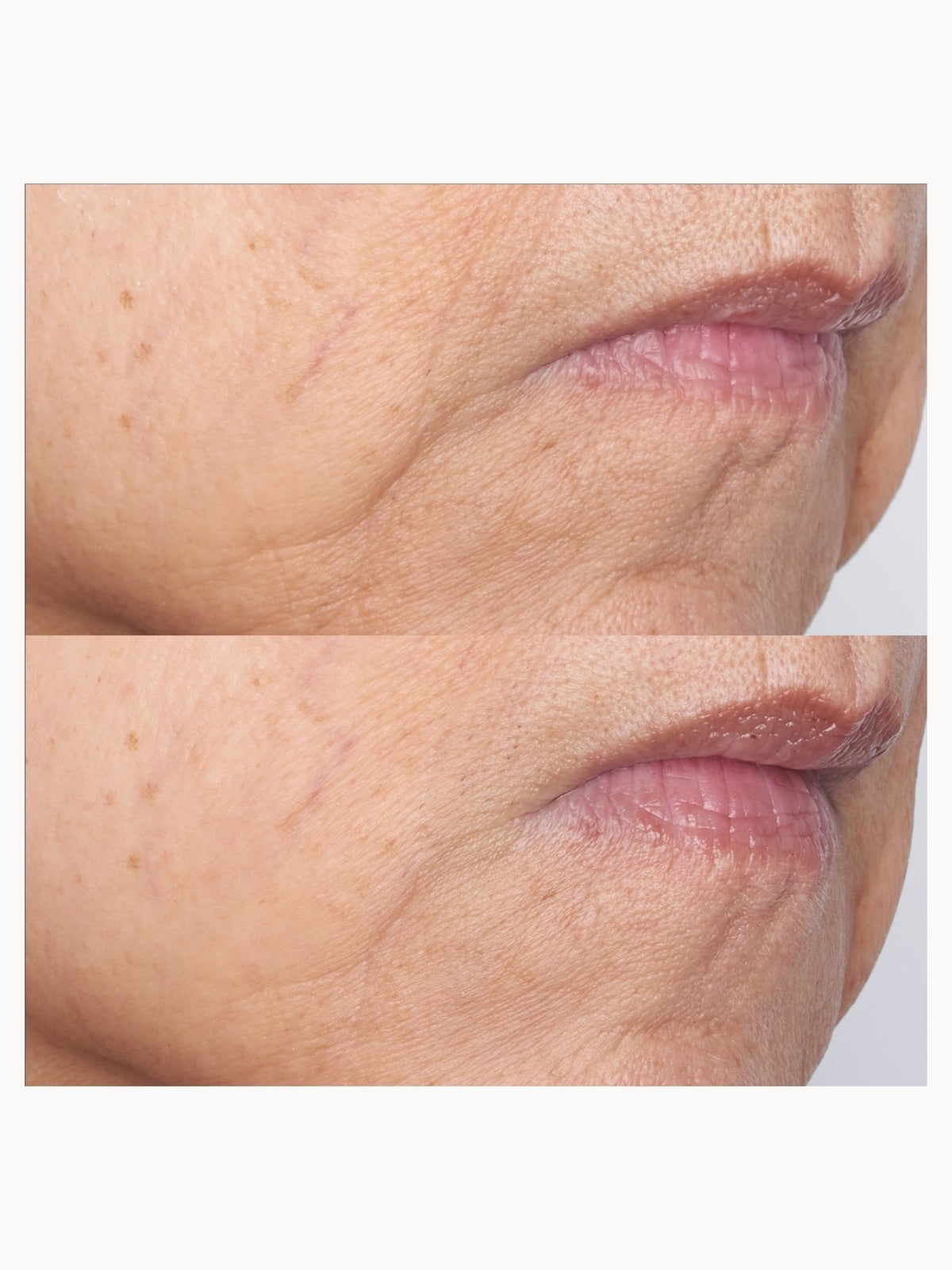 Perricone MD Cold Plasma Plus+ The Intensive Gel Mask 59ml 4