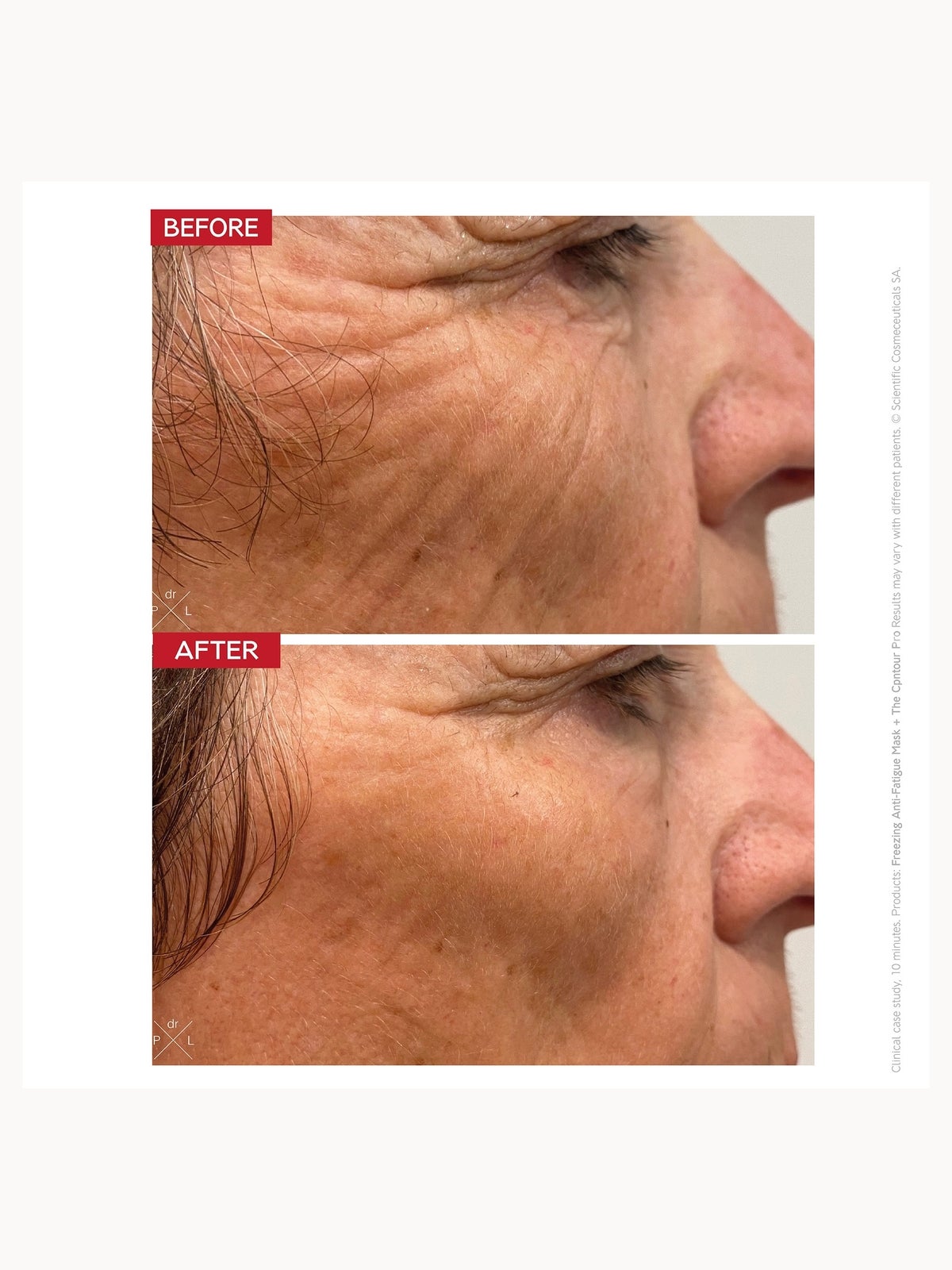 Dr. LEVY Switzerland The Contour Pro 3