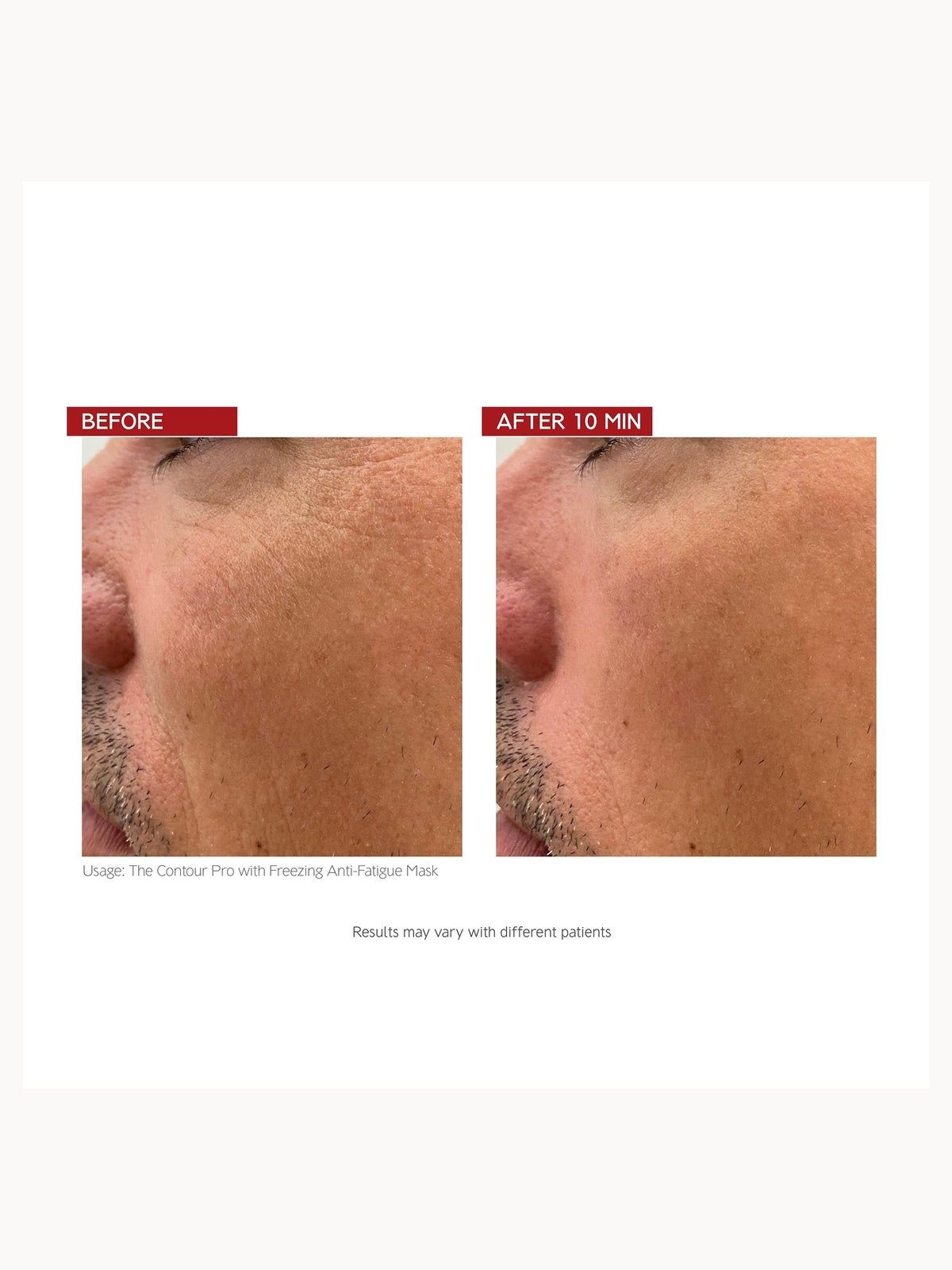 Dr. LEVY Switzerland The Contour Pro 4