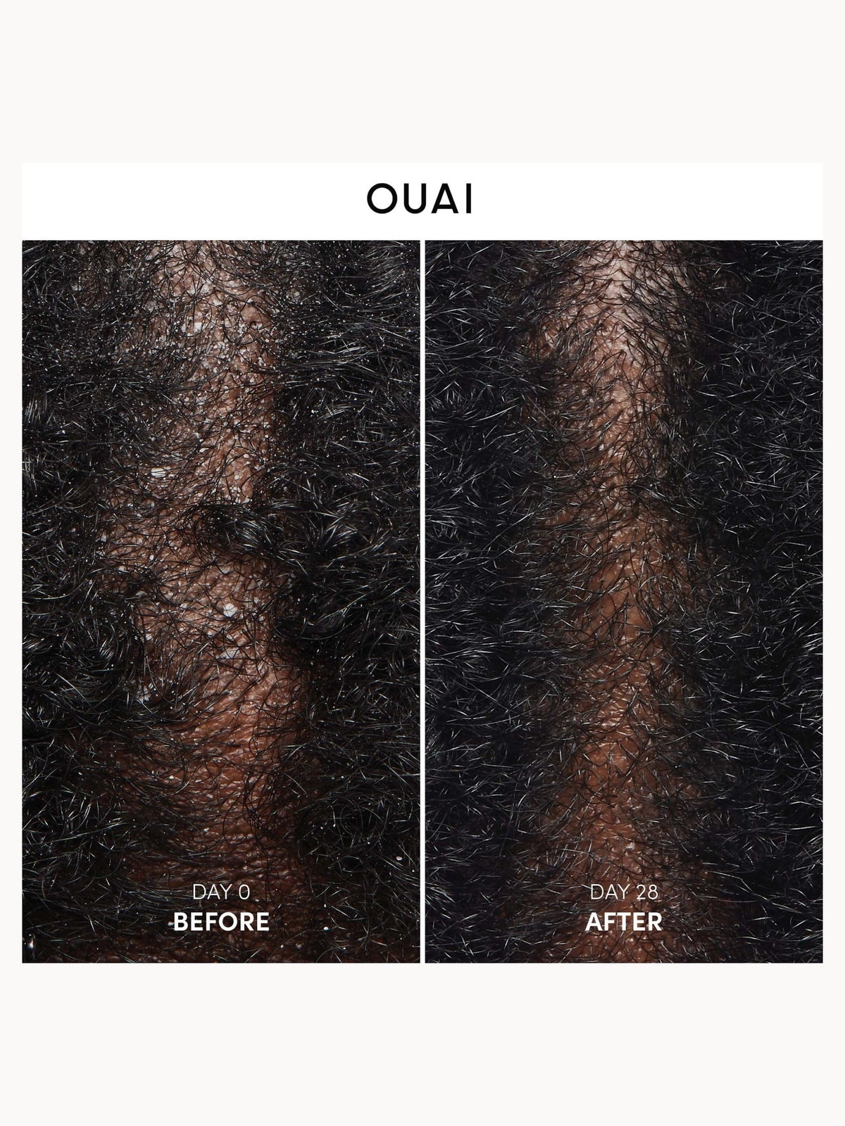 OUAI Anti-Dandruff Shampoo 300ml 2
