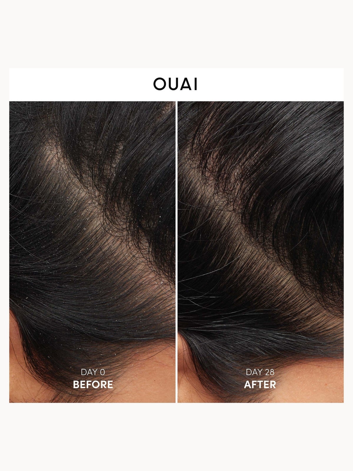 OUAI Anti-Dandruff Shampoo 300ml 3