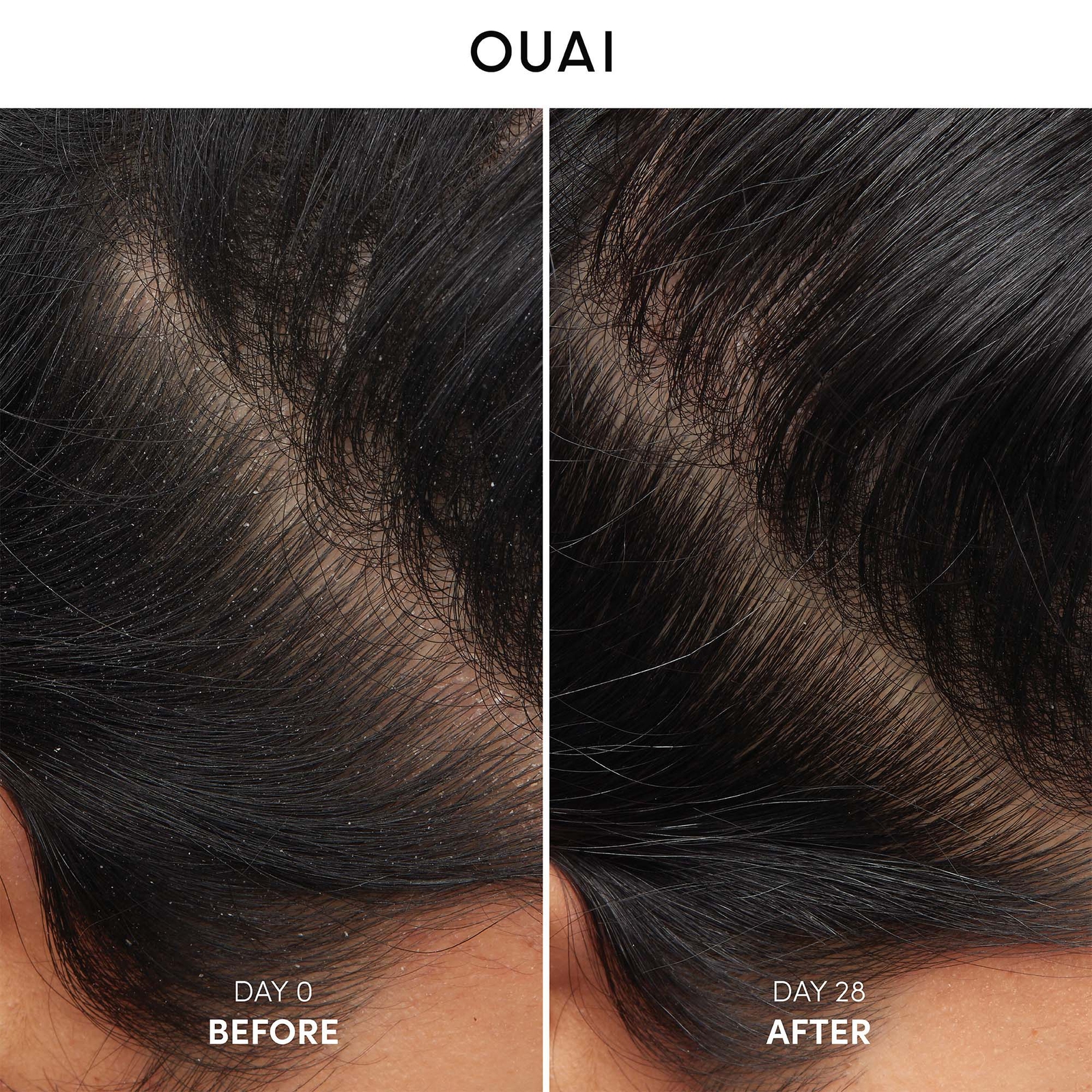 Thumbnail - OUAI Anti-Dandruff Shampoo 300ml