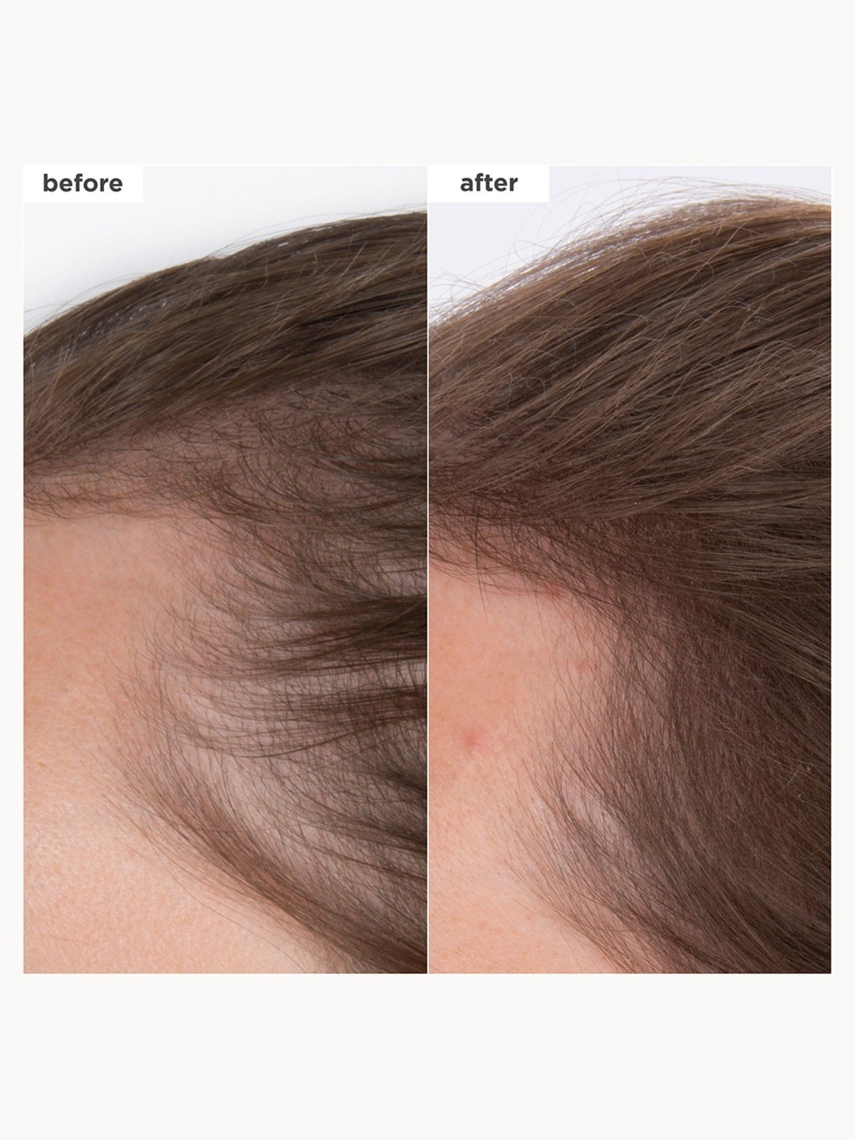 Briogeo Destined for Density MegaStrength+ Caffeine and Biotin Peptide Density Serum 45ml 2