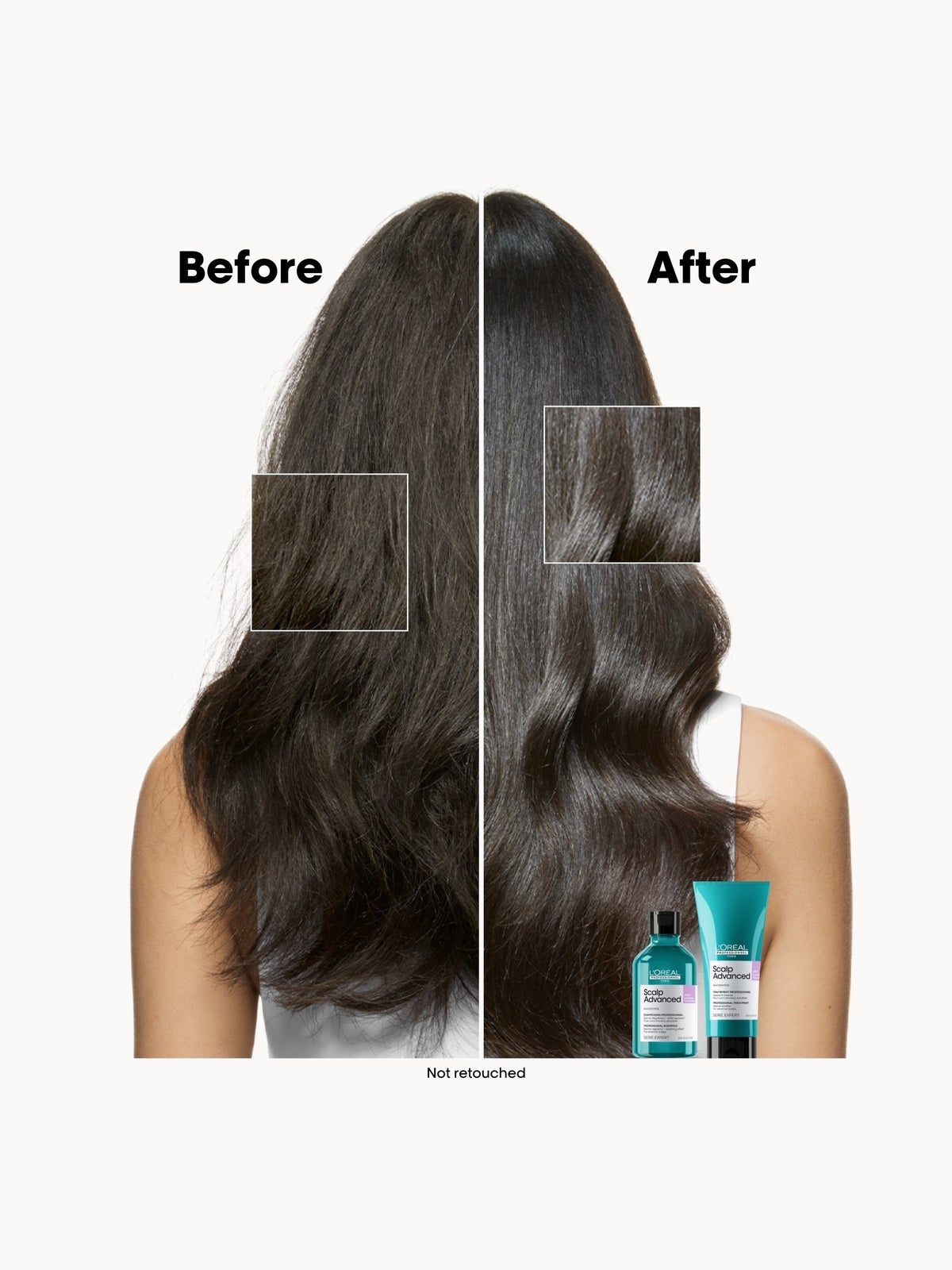 L'Oreal Professionnel Serie Expert Shampoo Scalp Advanced Anti-discomfort Dermo Regulator 300ml, photo 3
