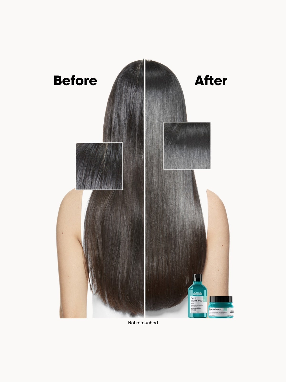 L'Oréal Professionnel Serié Expert Scalp Advanced Anti-Oiliness 2-in-1 Deep Purifier Clay Hair Mask 250ml, photo 3