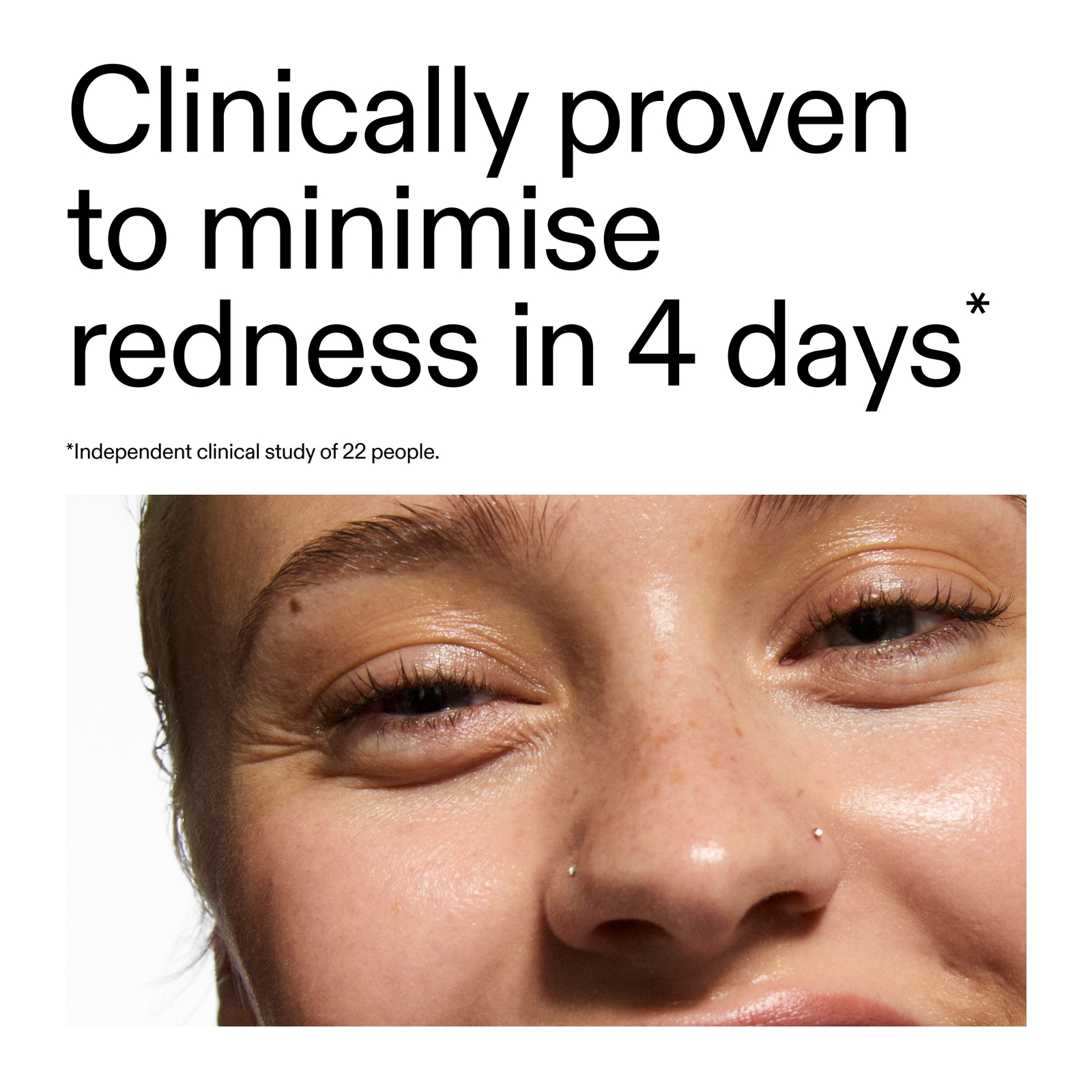 Thumbnail - The INKEY List Super Solutions 10% Azelaic Acid Serum 30ml