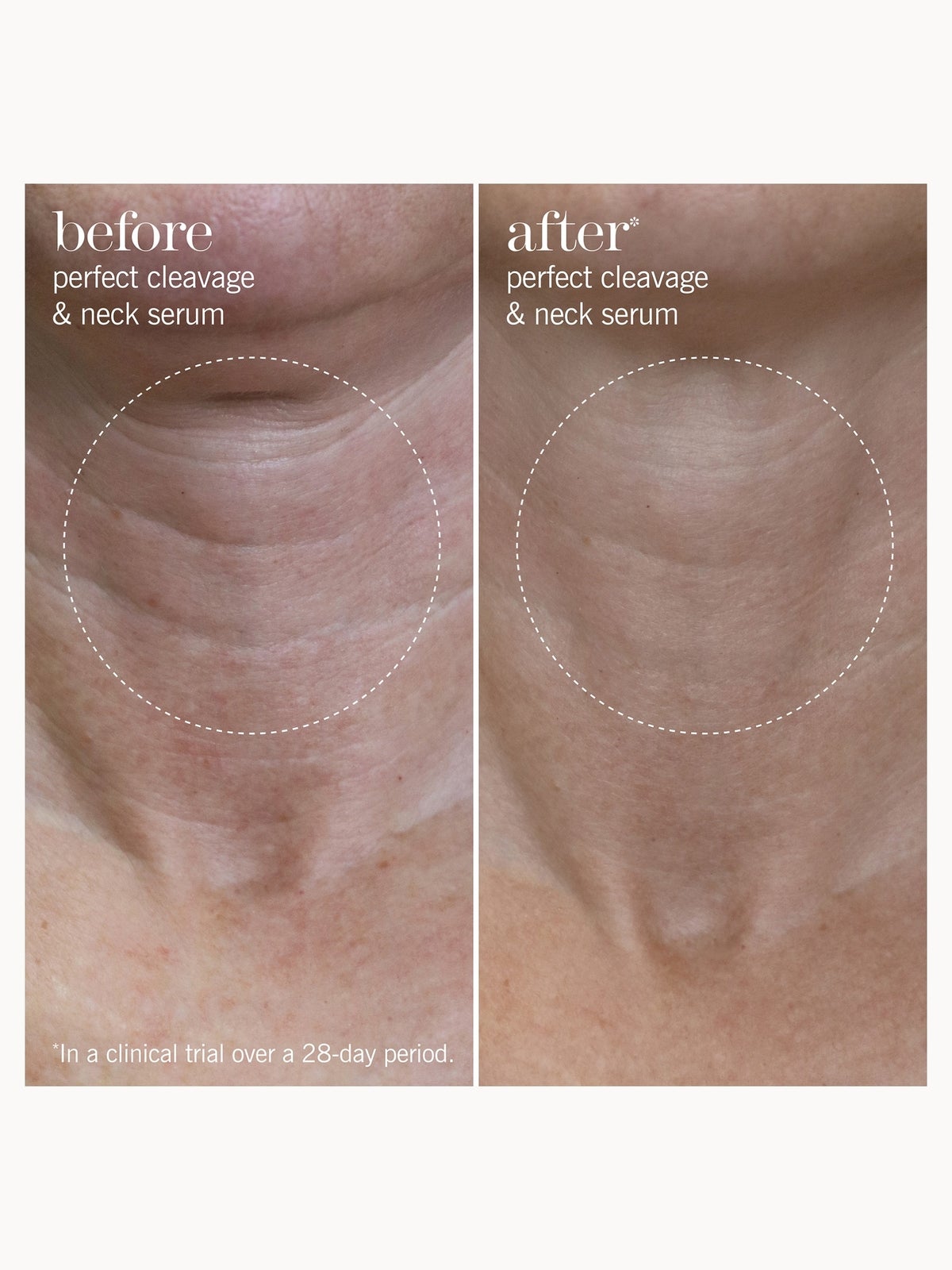 This Works Perfect Cleavage and Neck Serum 150ml 3